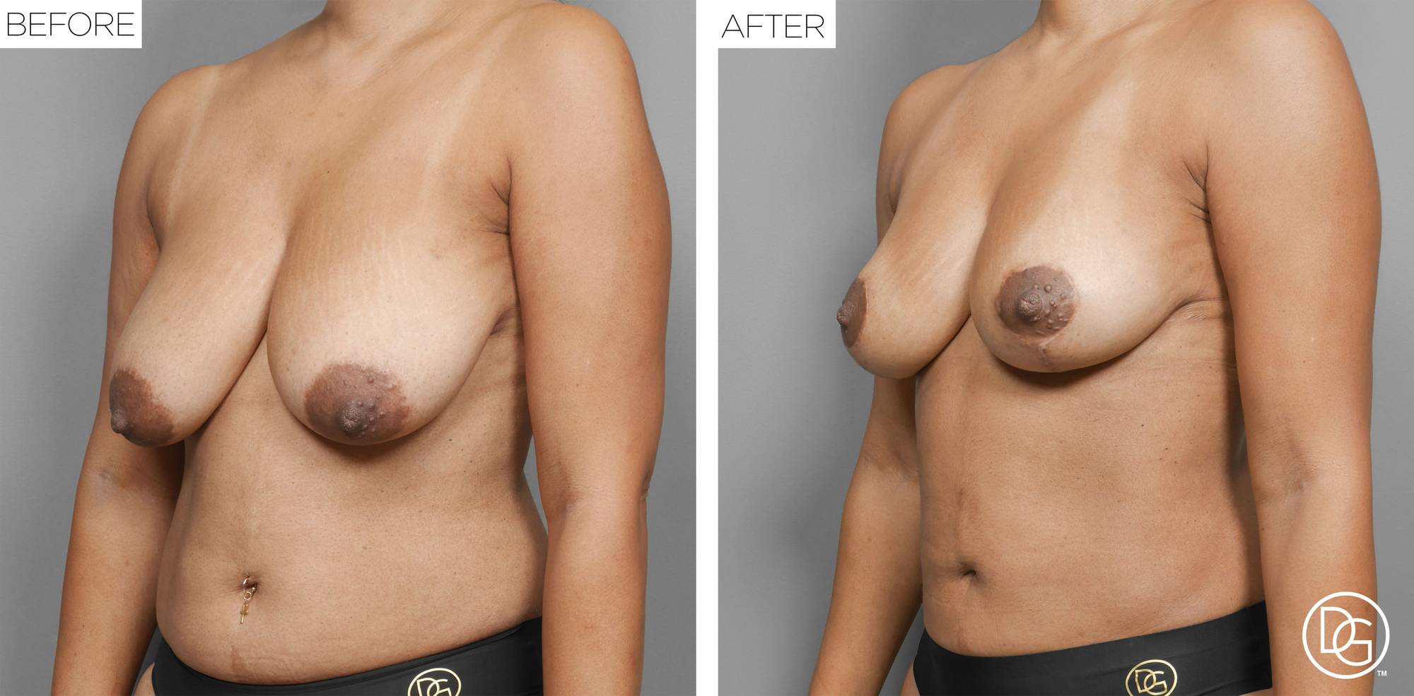 Before & After Image