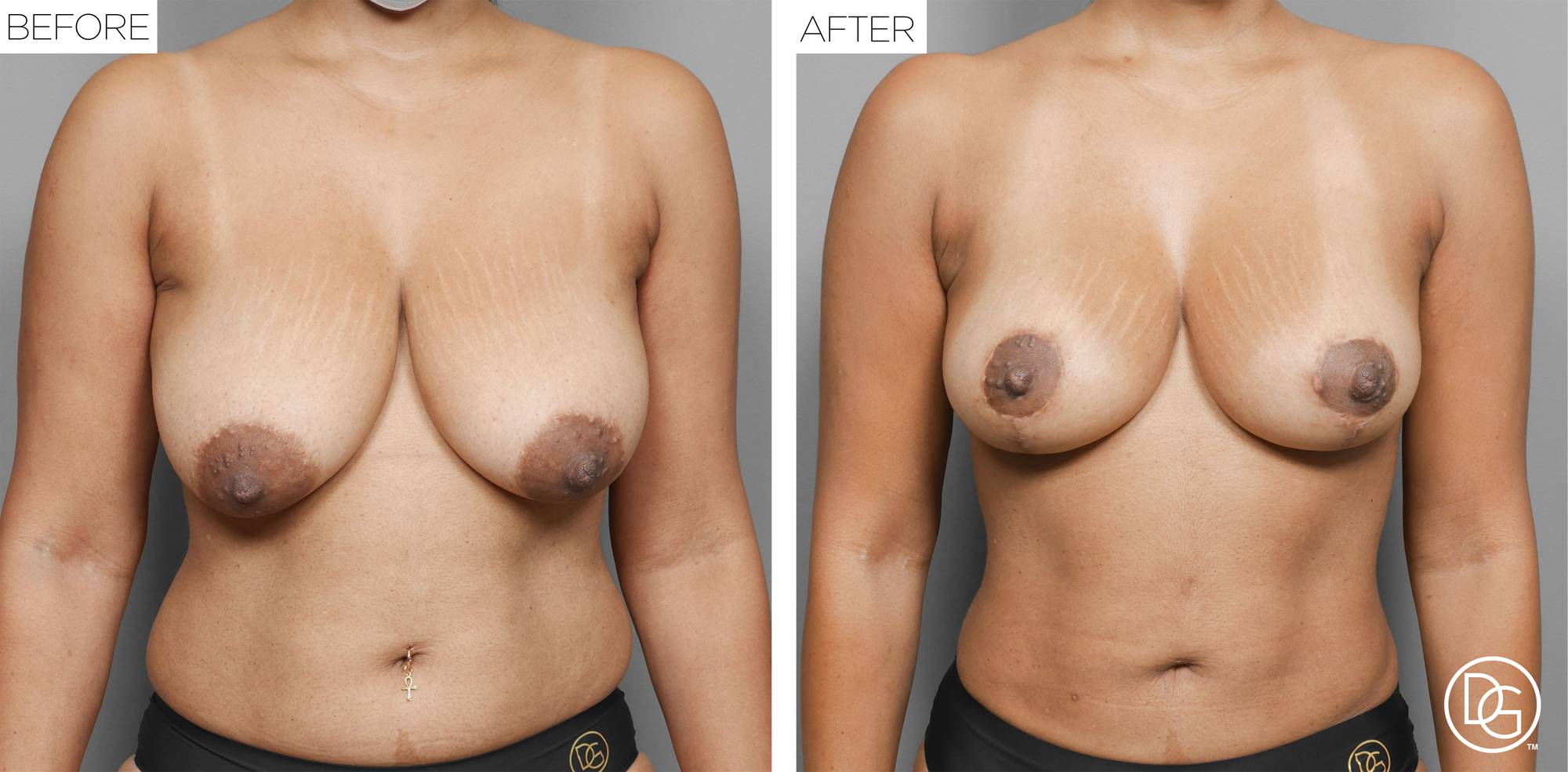 Before & After Image