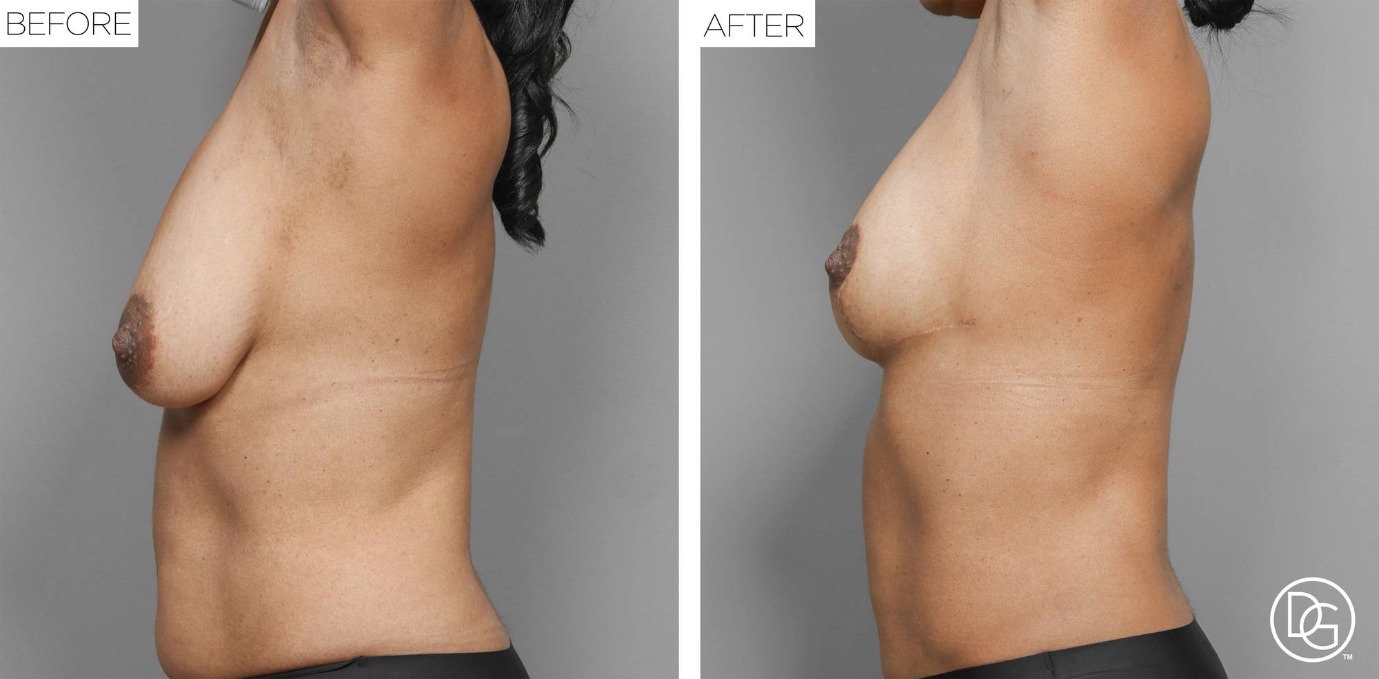 Before & After Image