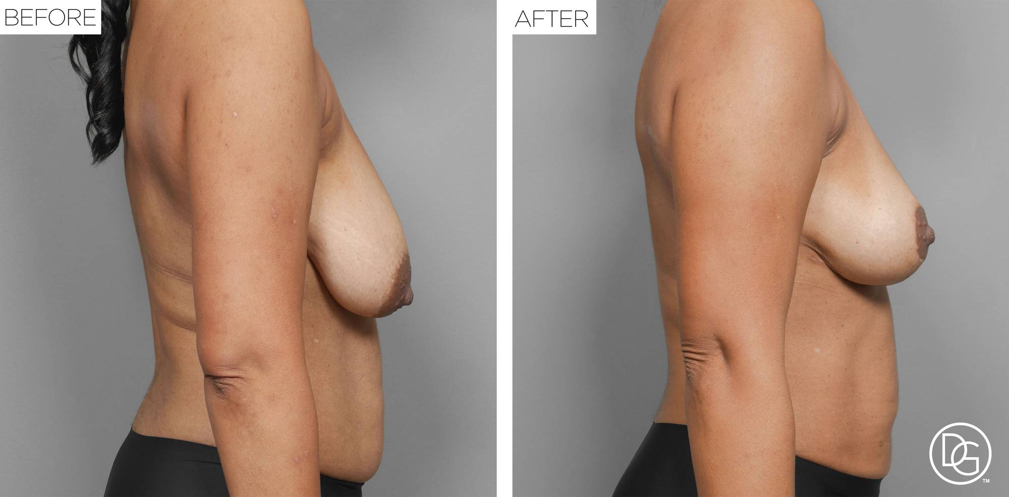 Before & After Image