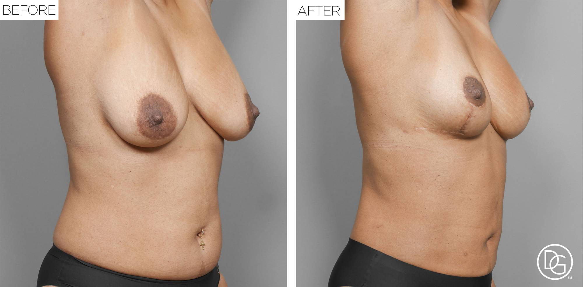 Before & After Image