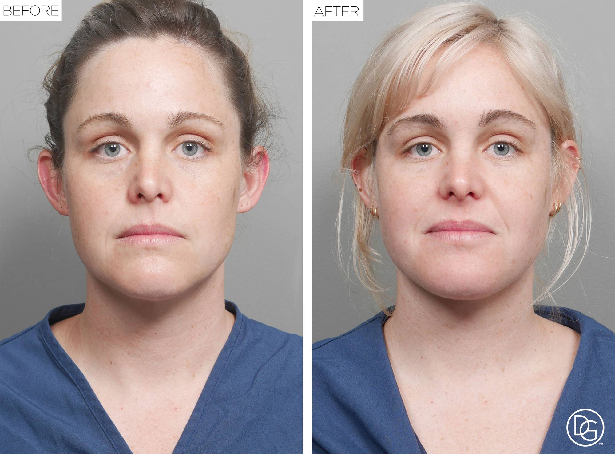 Weekend Lift Before & After Image