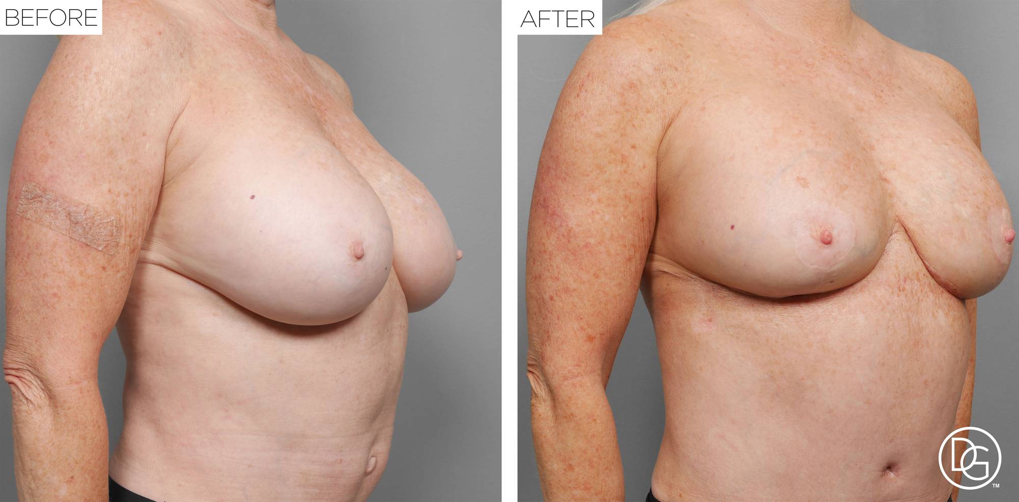 Before & After Image