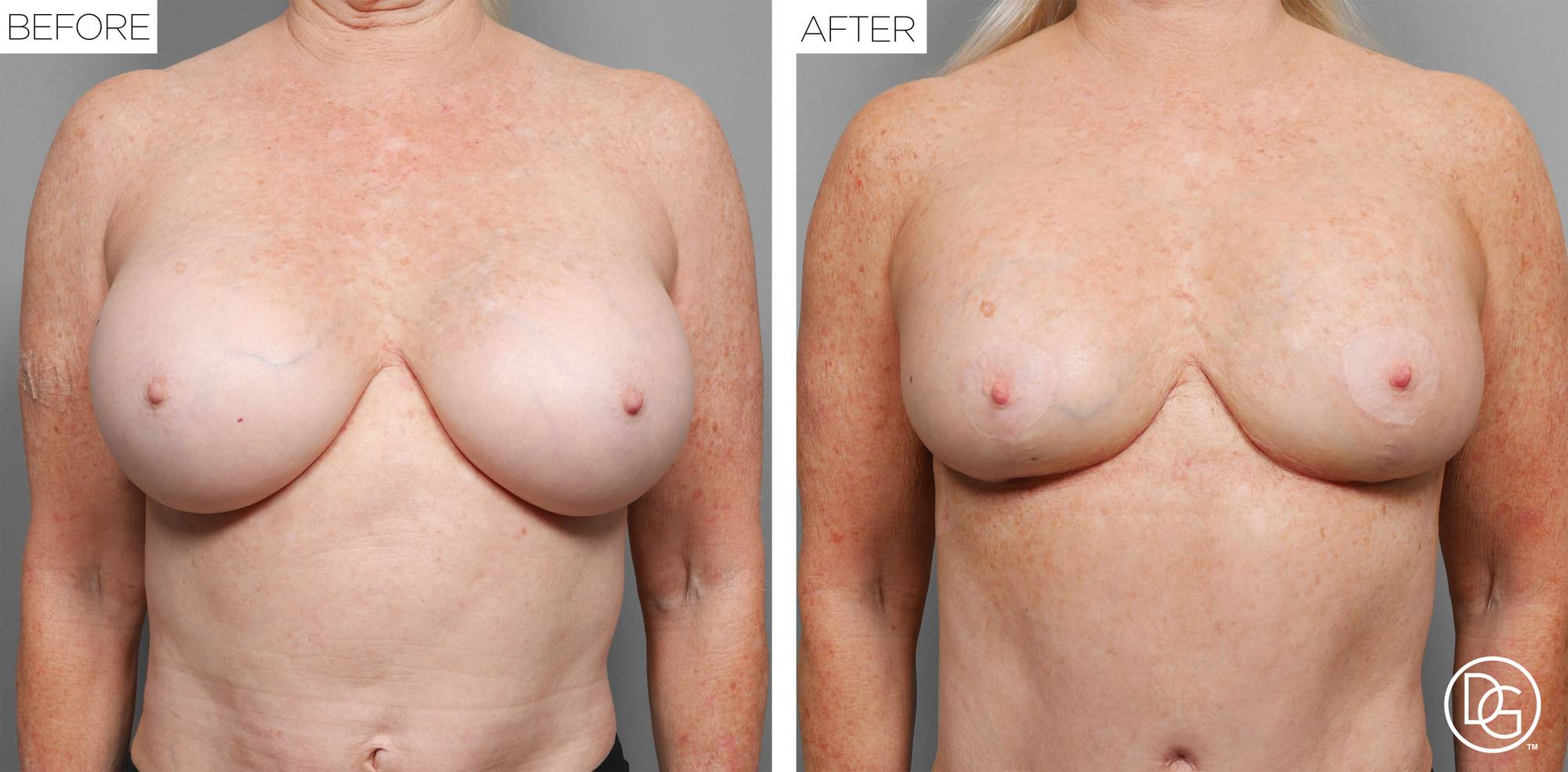 Before & After Image