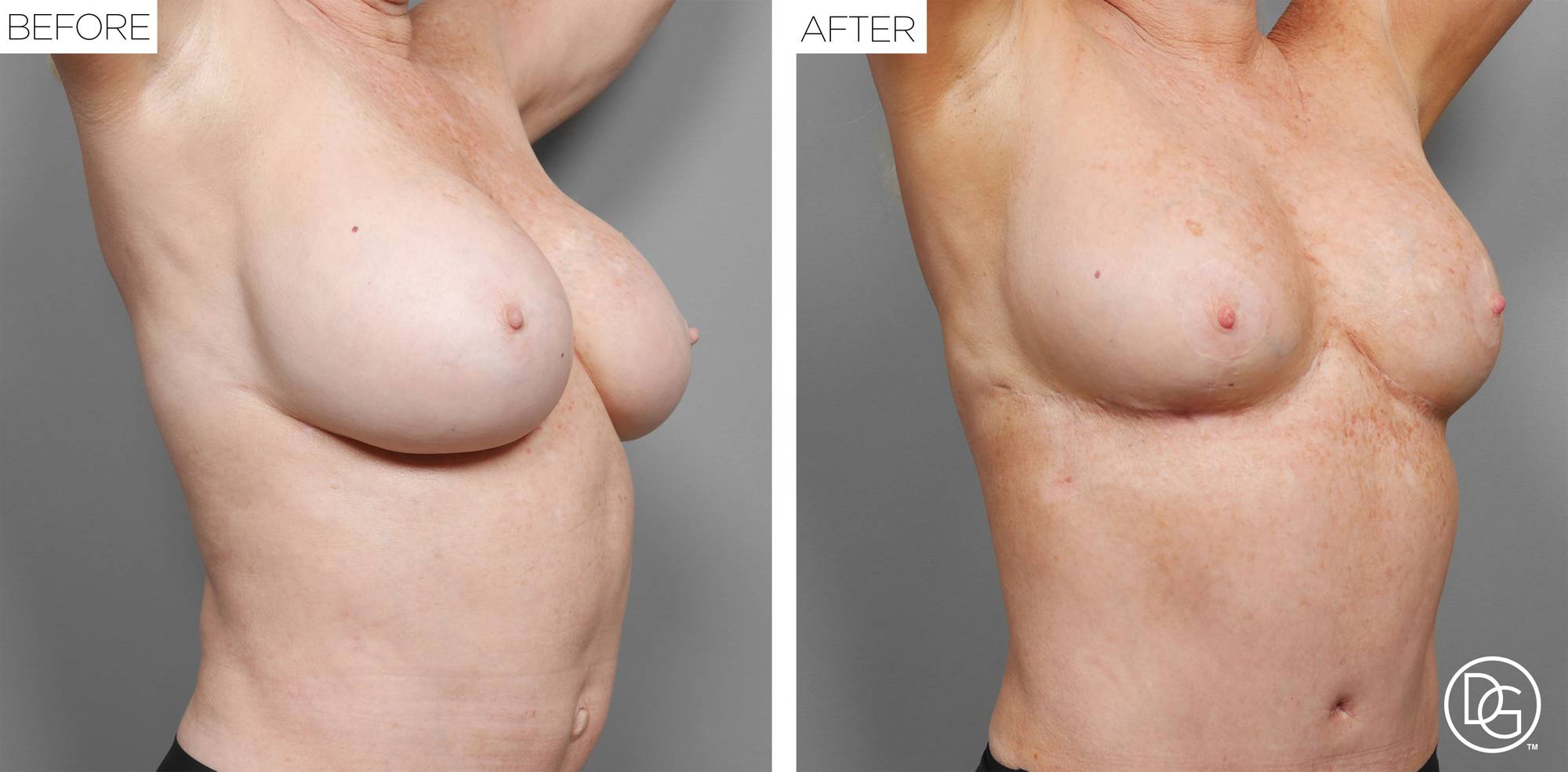 Before & After Image