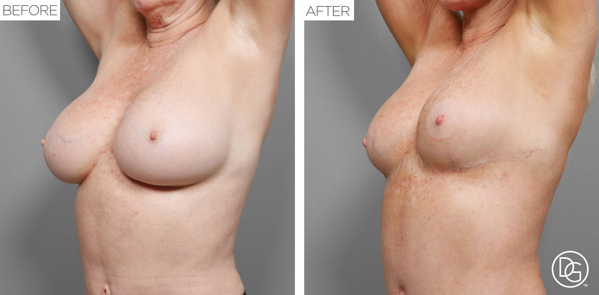 Before & After Image