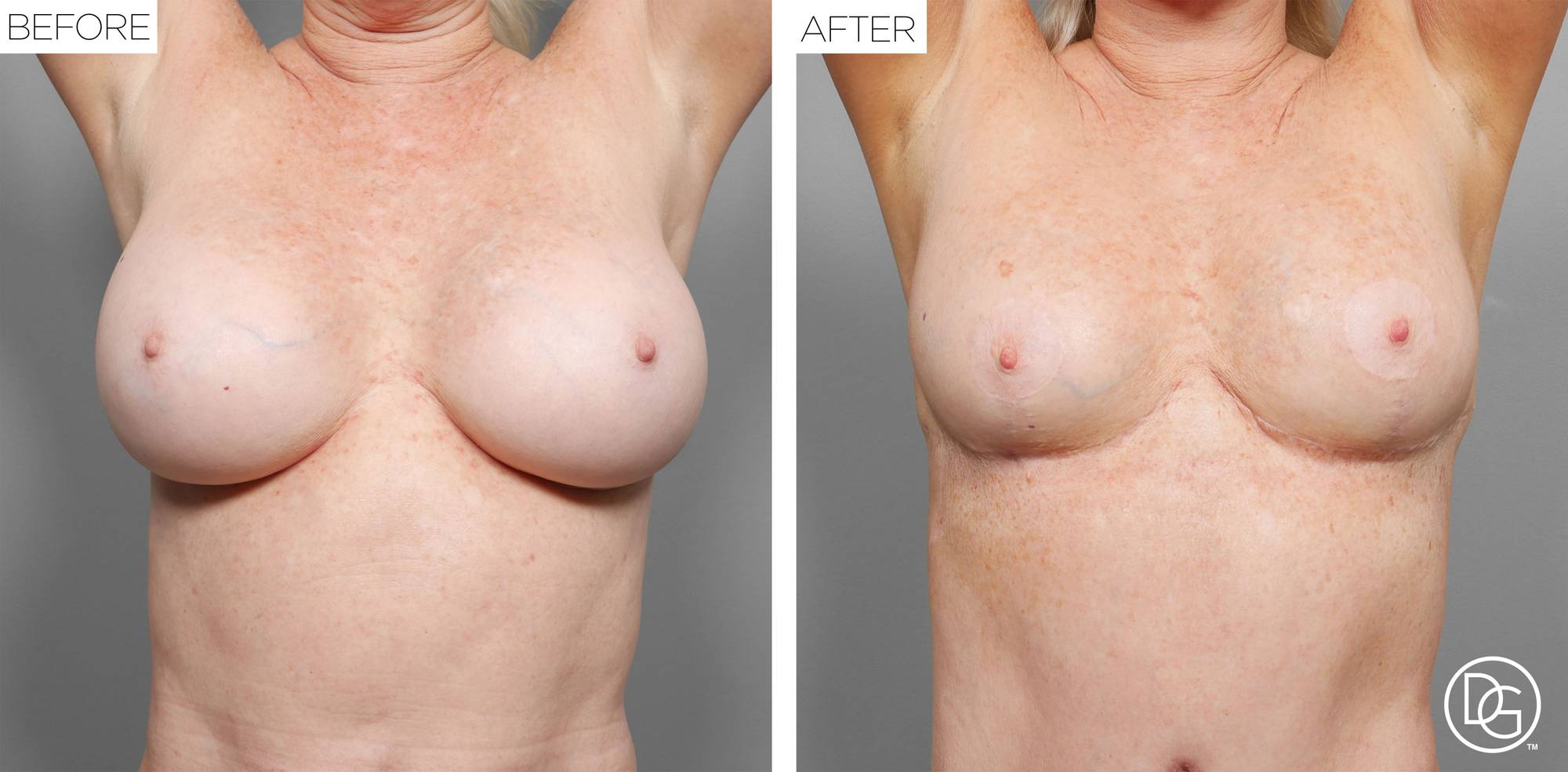 Before & After Image