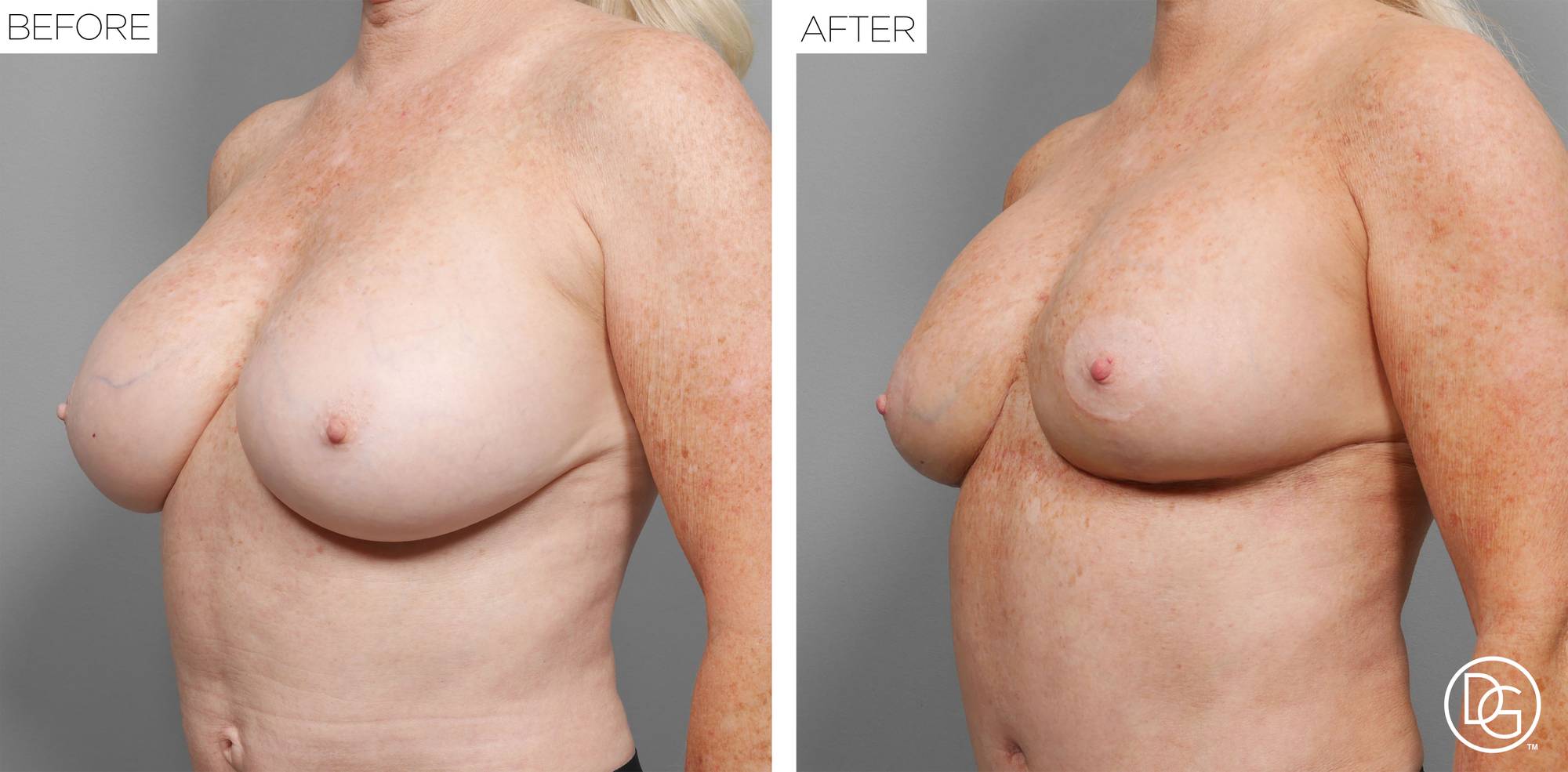 Before & After Image