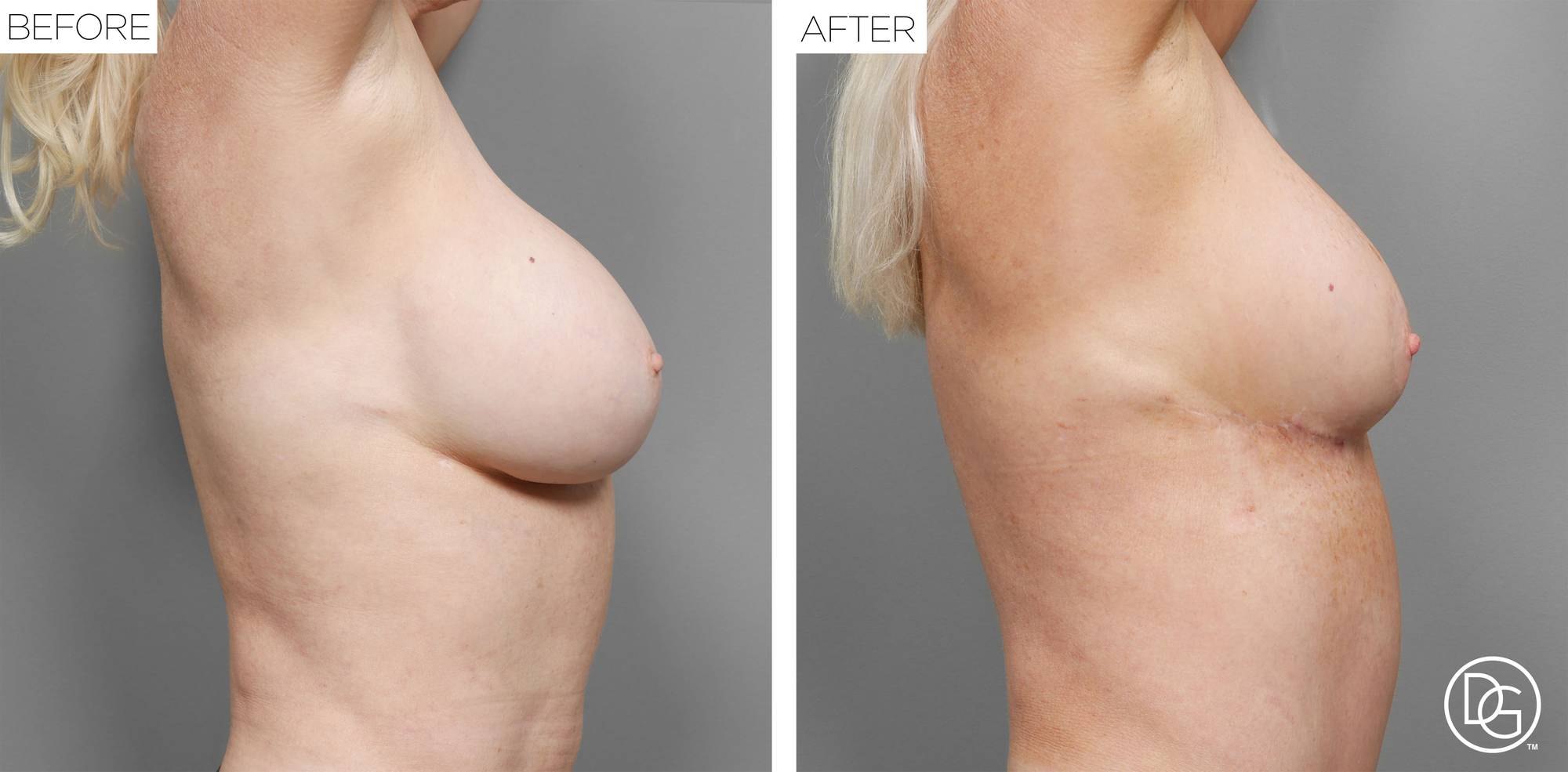 Before & After Image