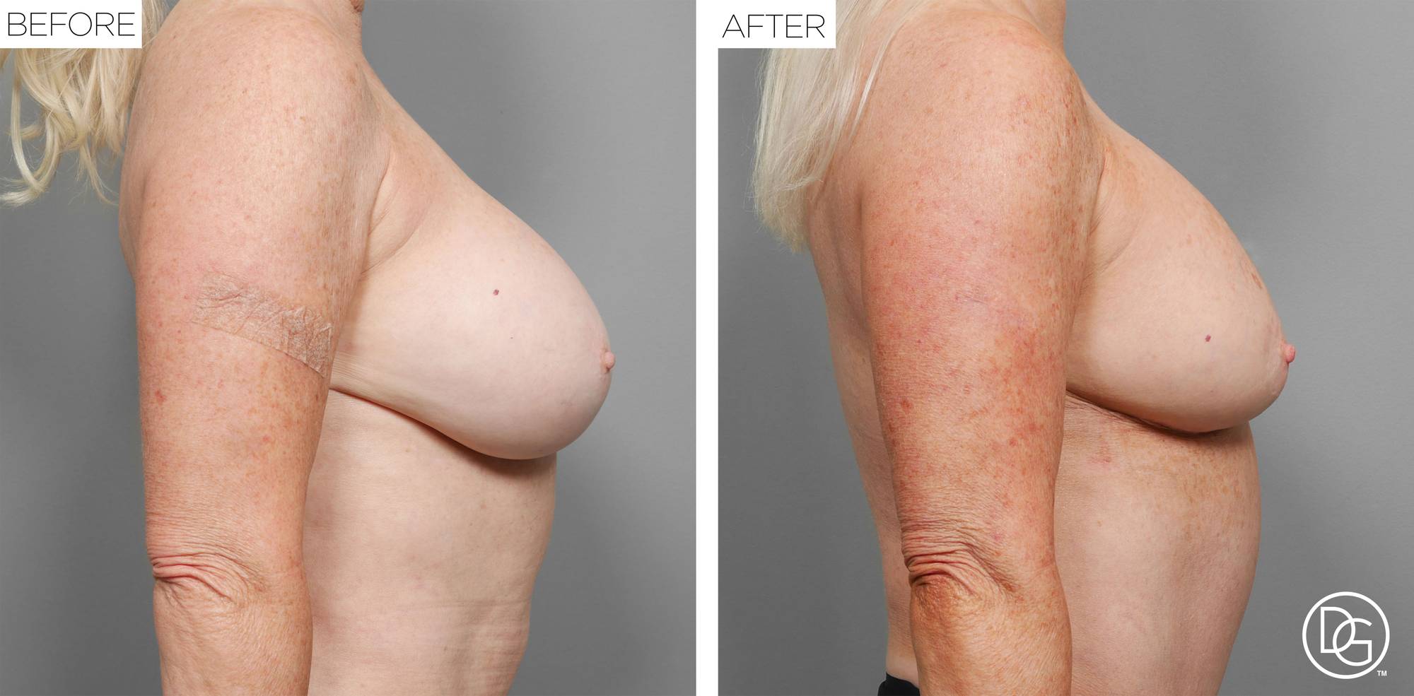 Before & After Image