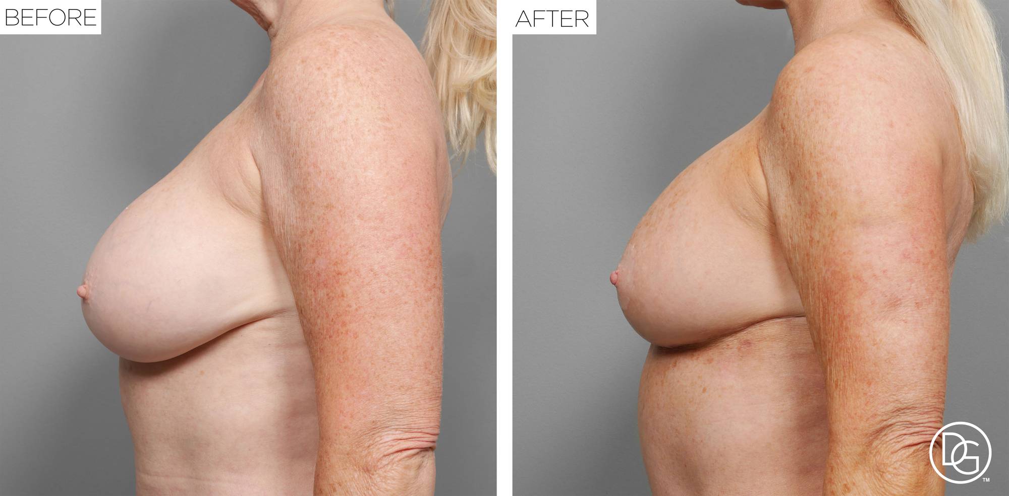 Before & After Image