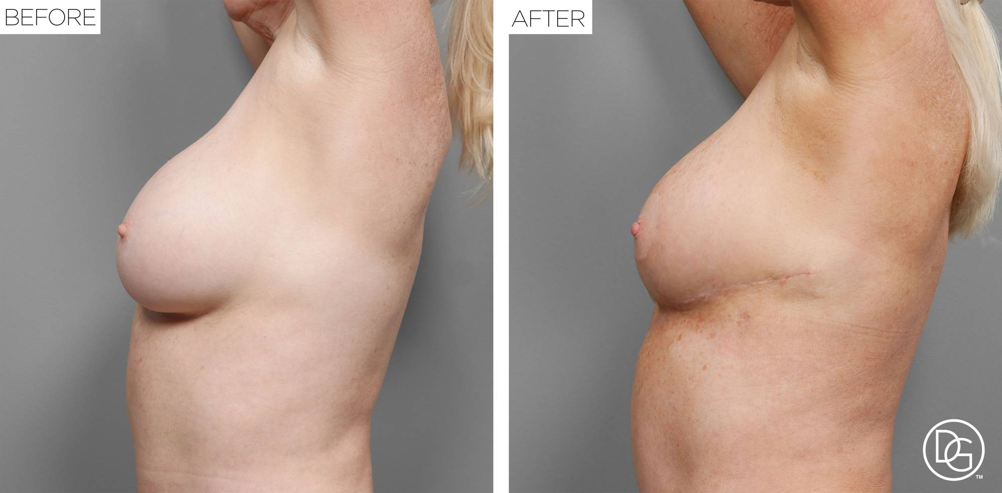 Before & After Image