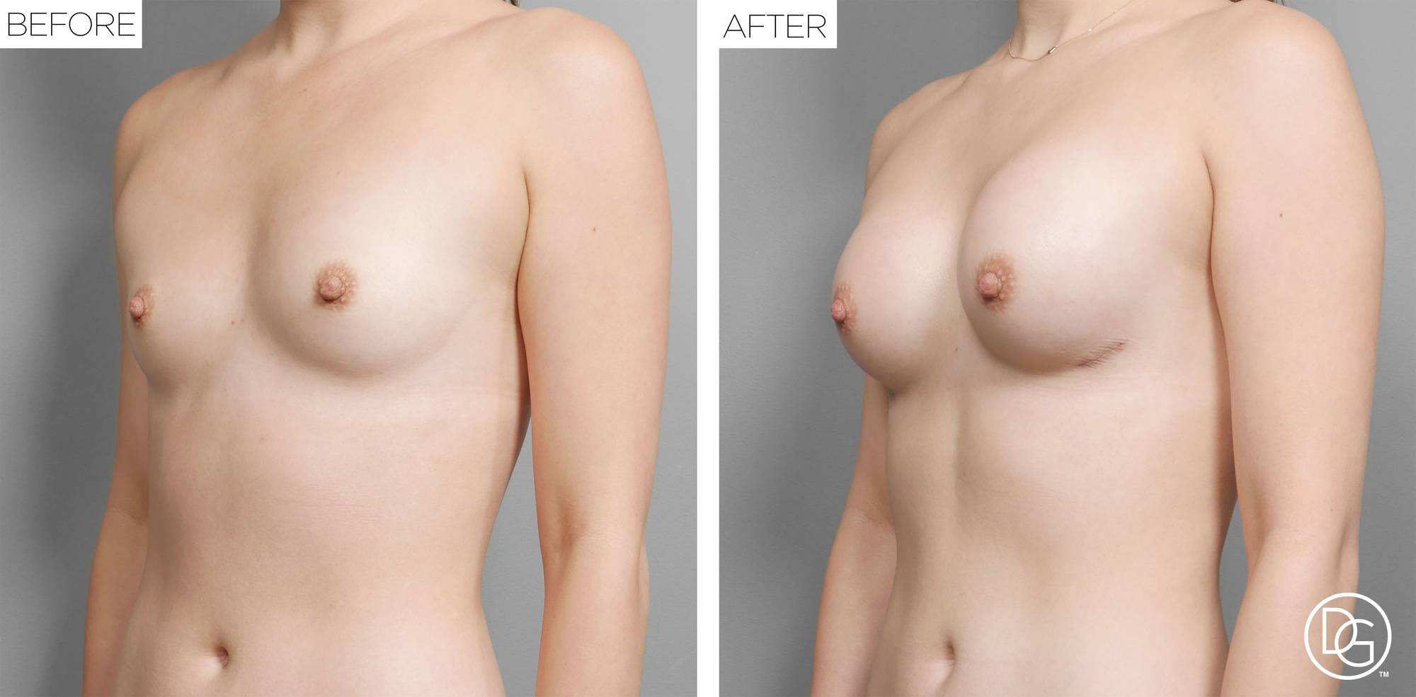 Before & After Image