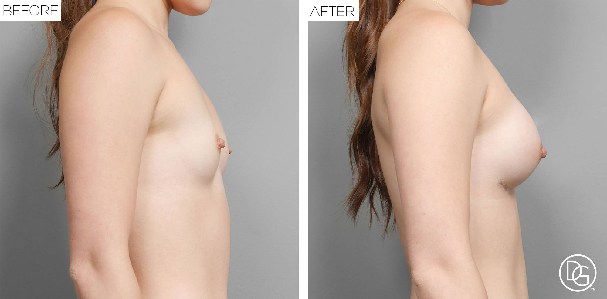 Before & After Image