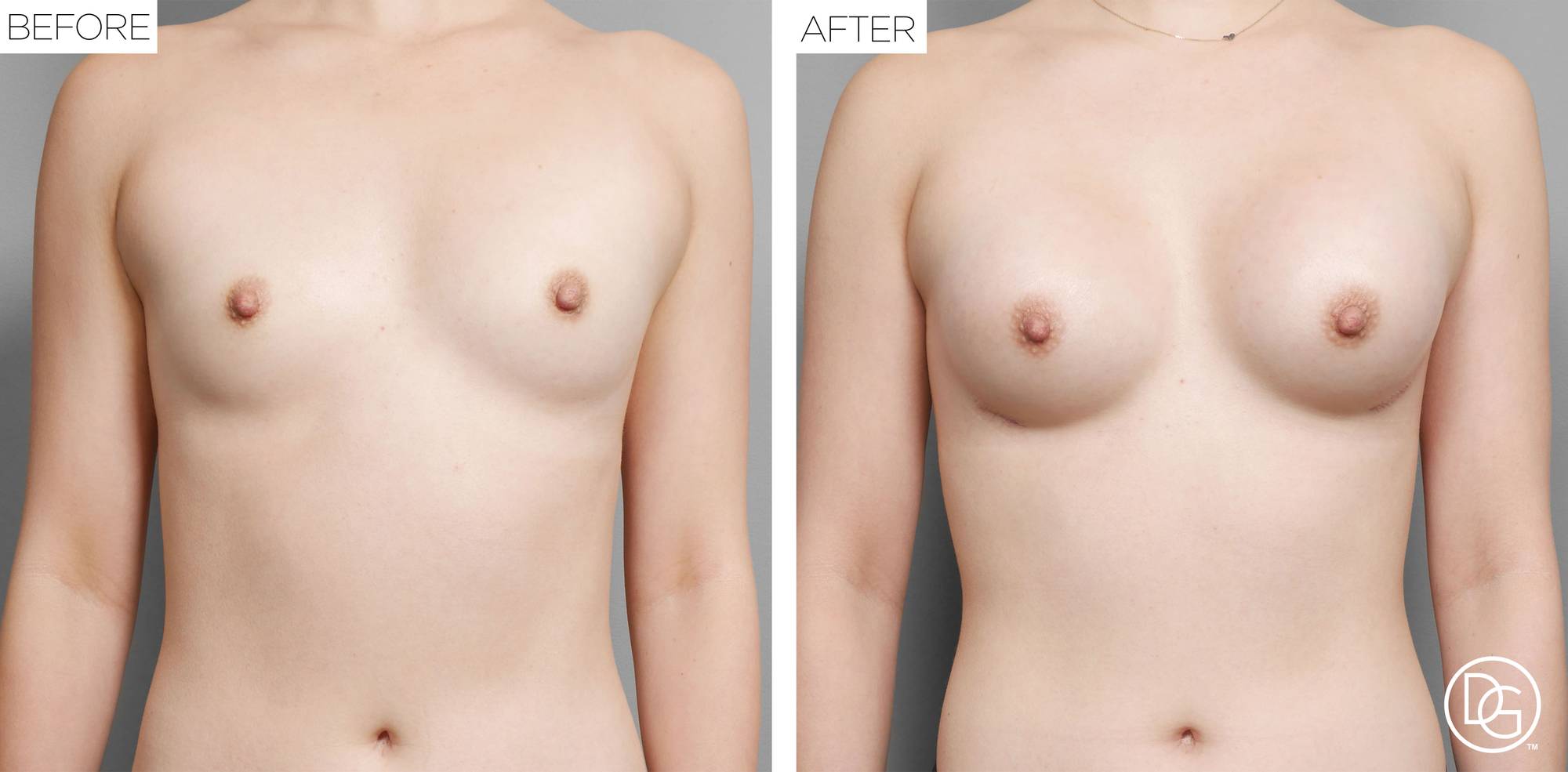 Before & After Image