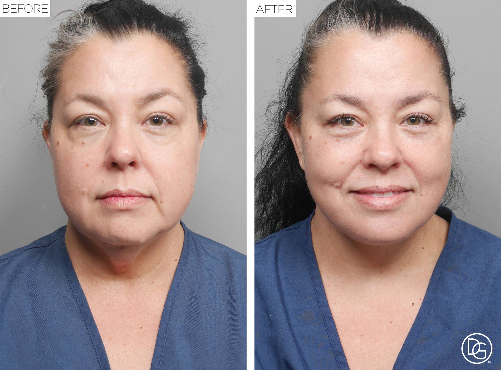 Before & After Image