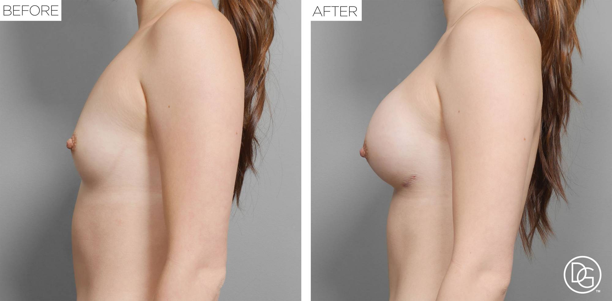 Before & After Image