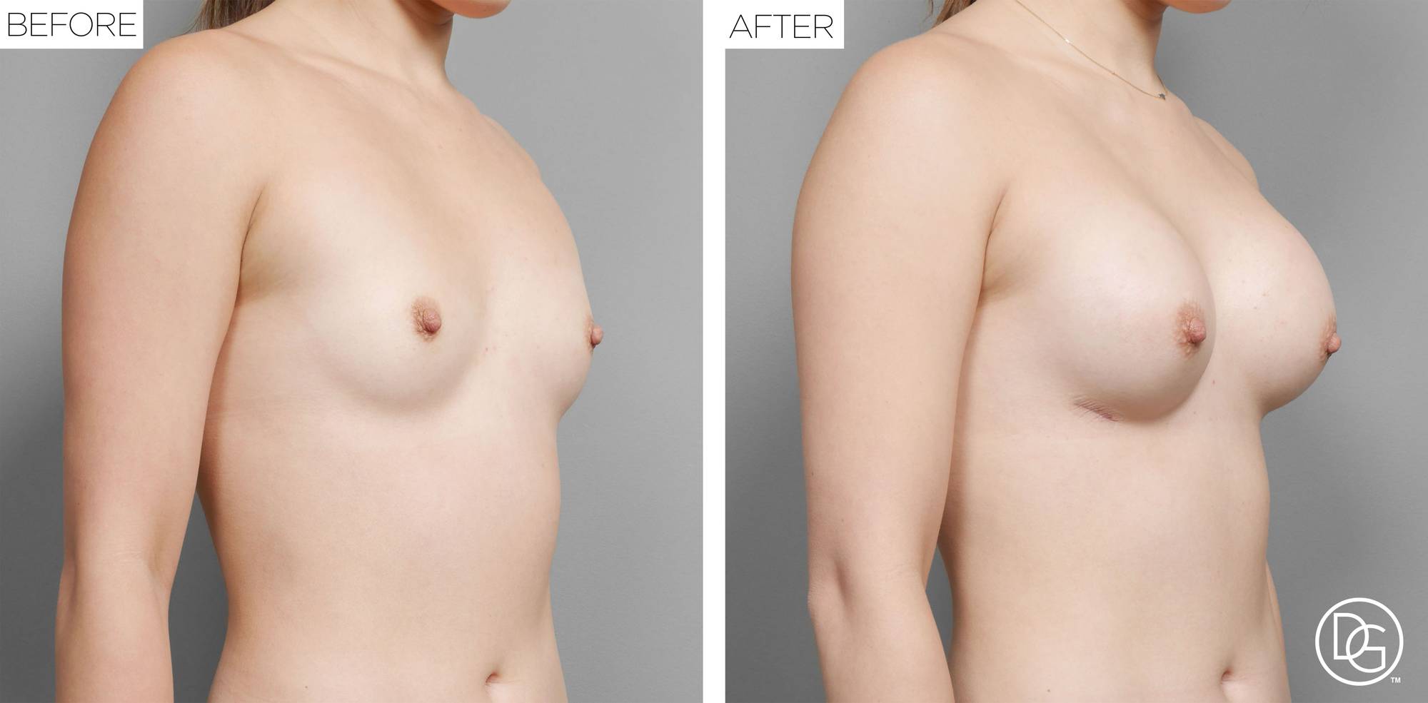 Before & After Image