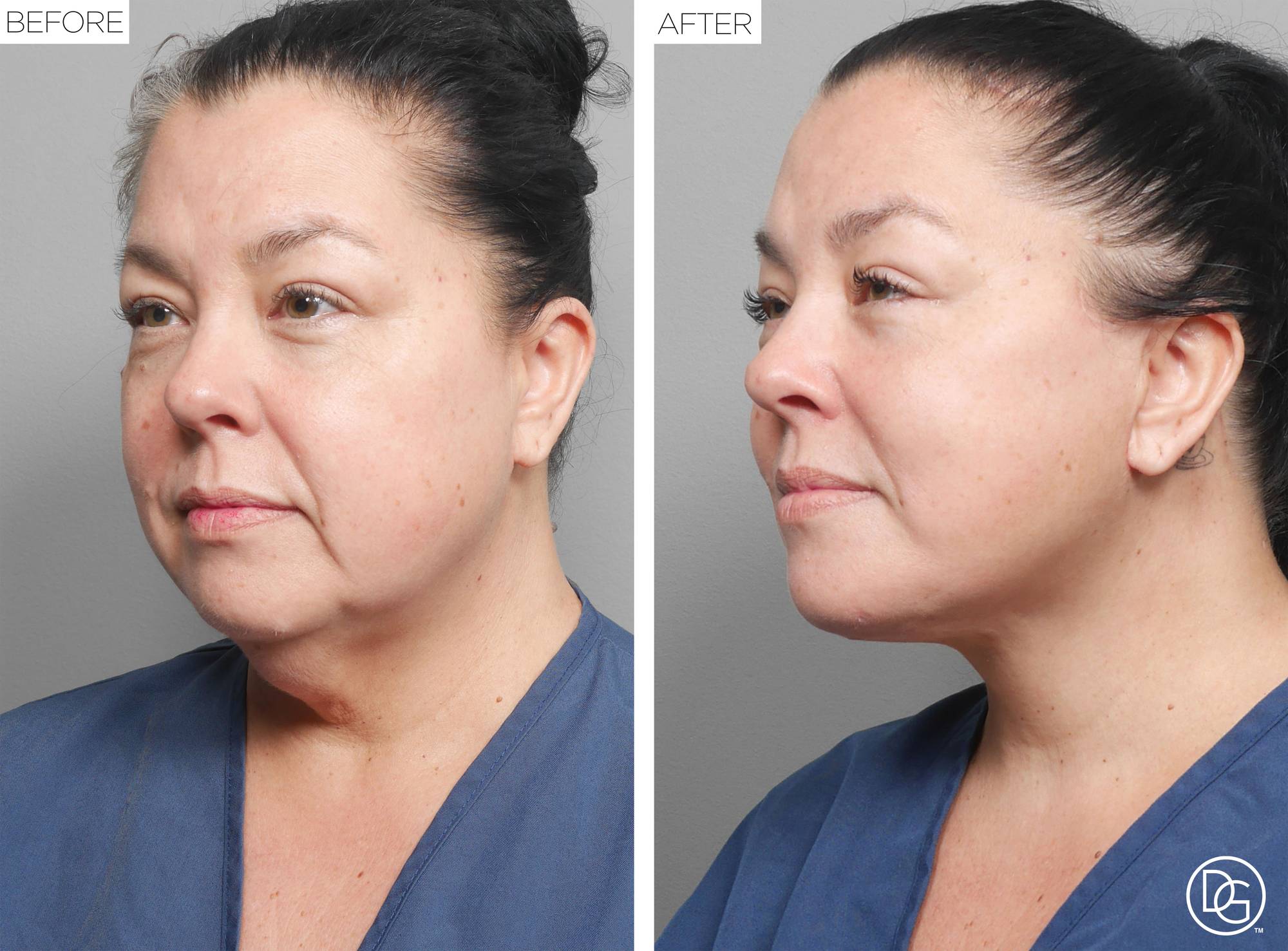 Before & After Image