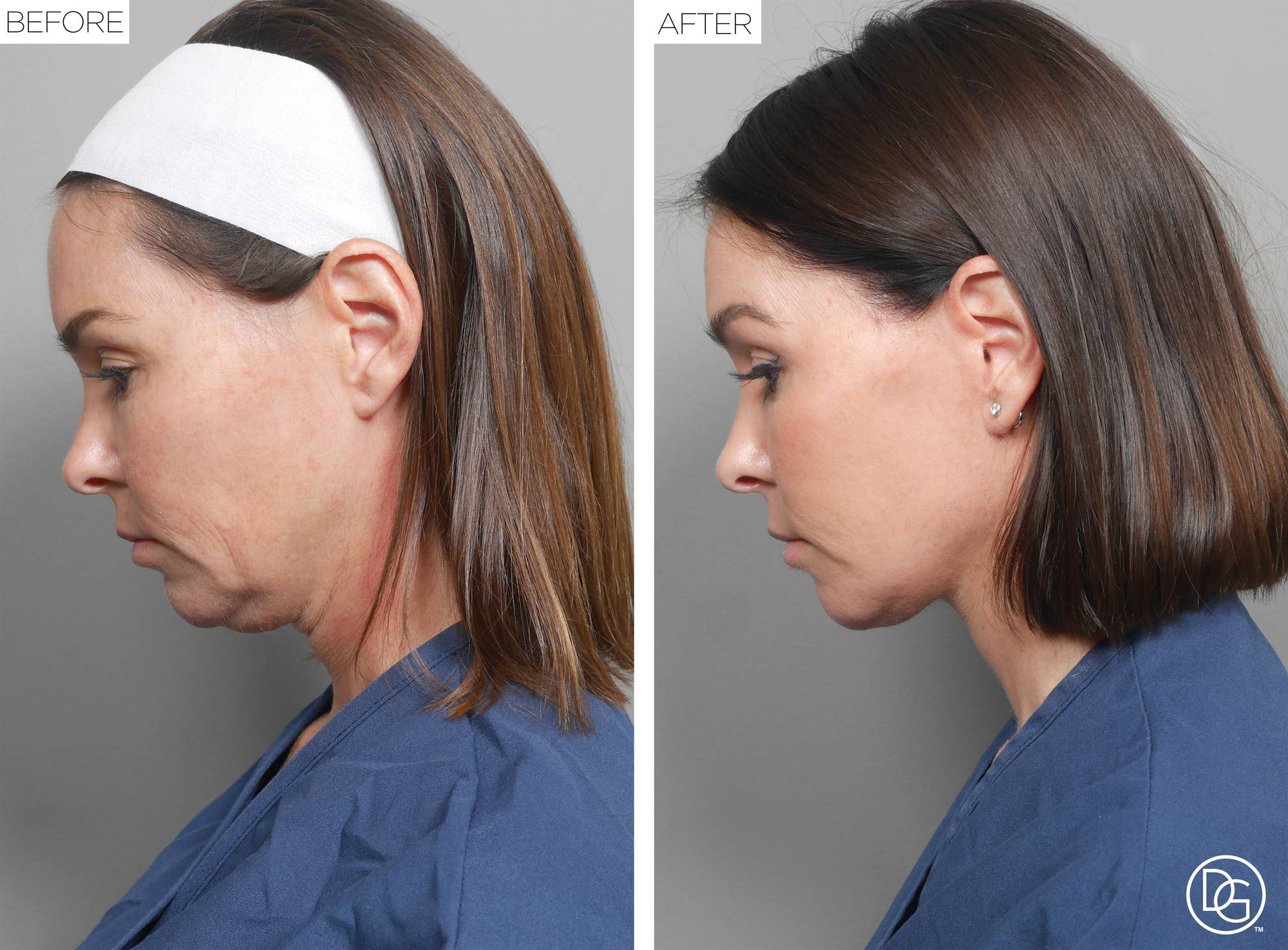 Before & After Image