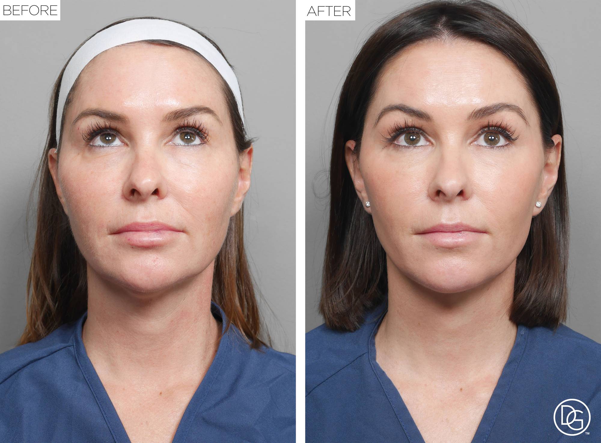 Before & After Image