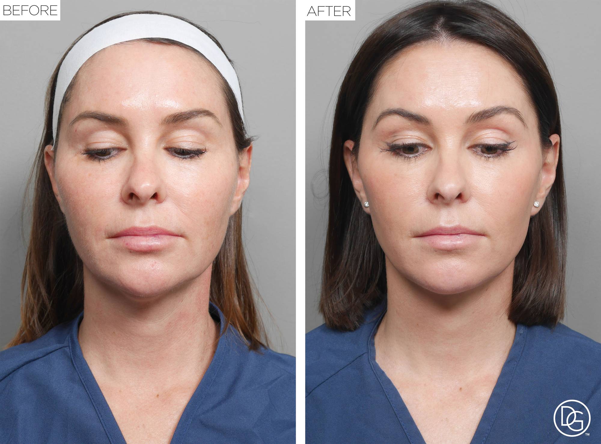 Before & After Image