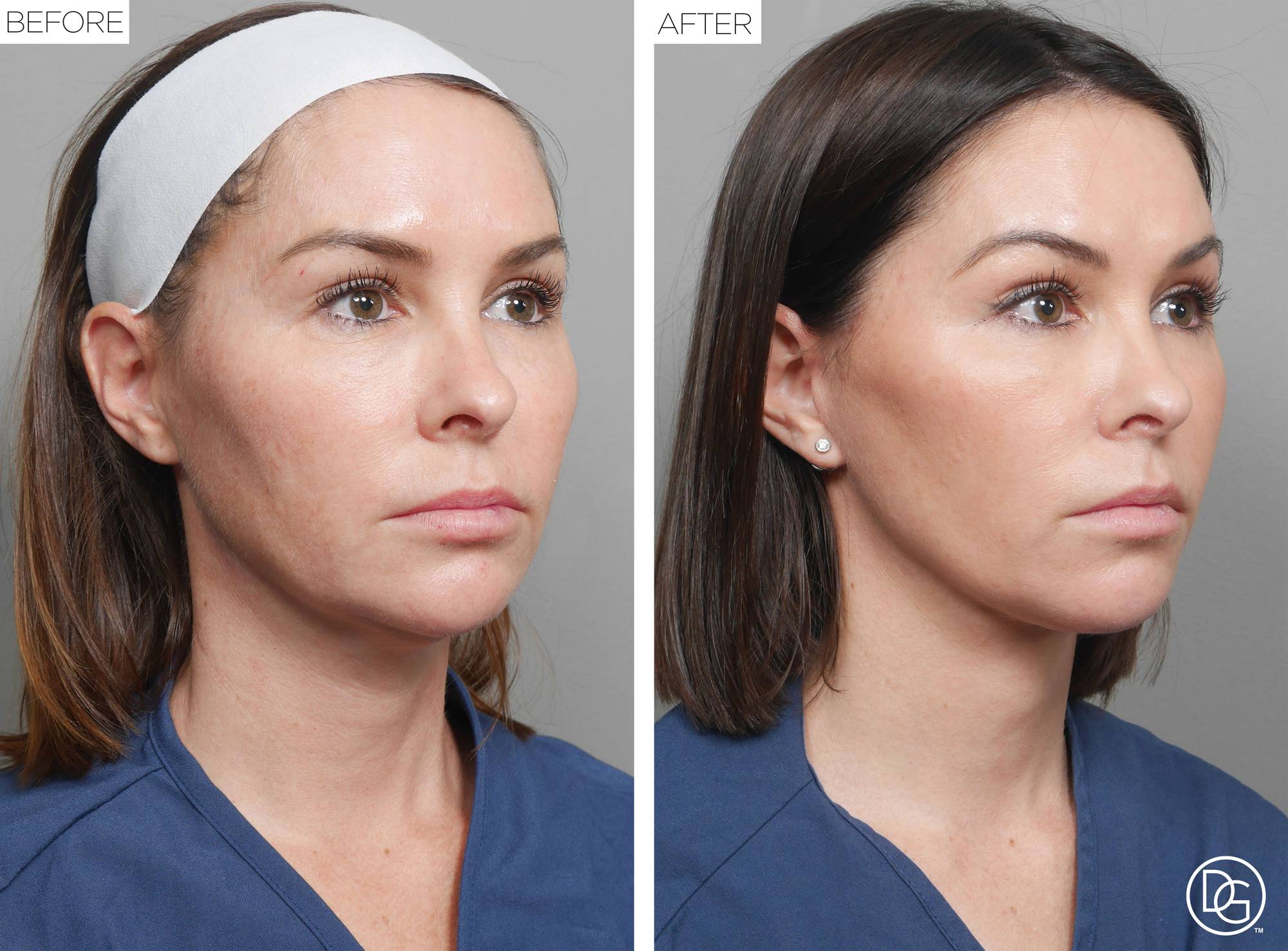 Before & After Image