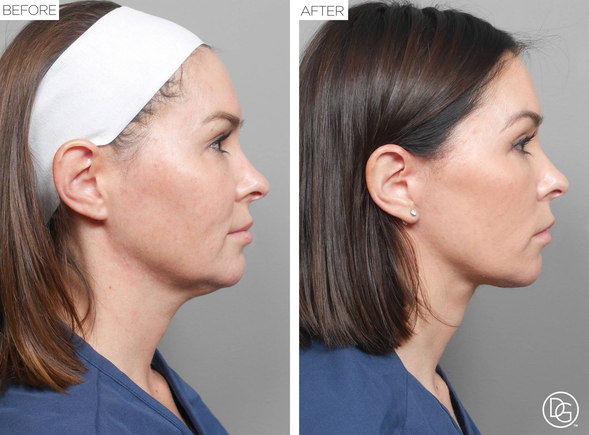 Before & After Image