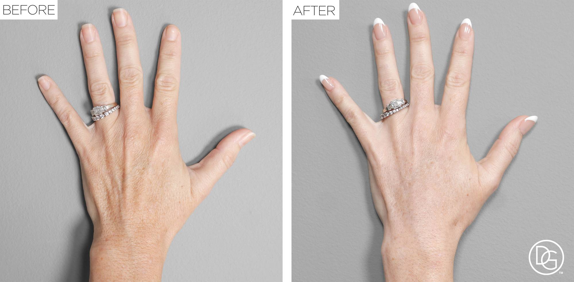 Before & After Image