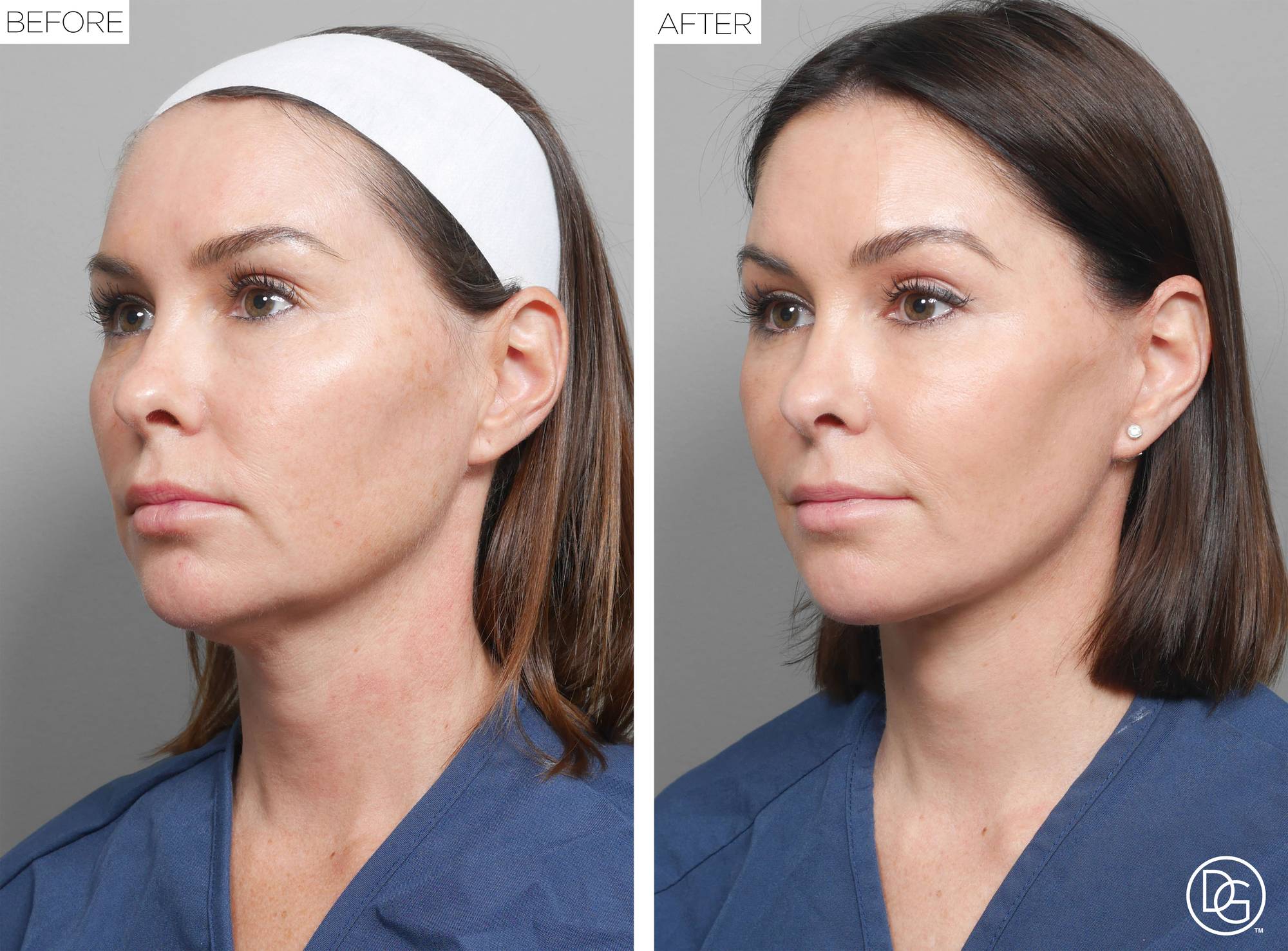 Before & After Image