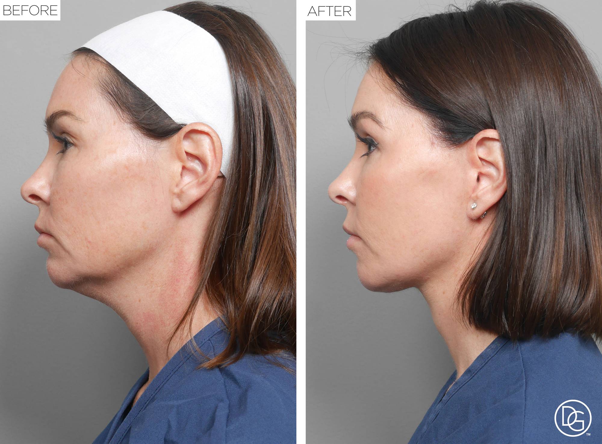 Before & After Image