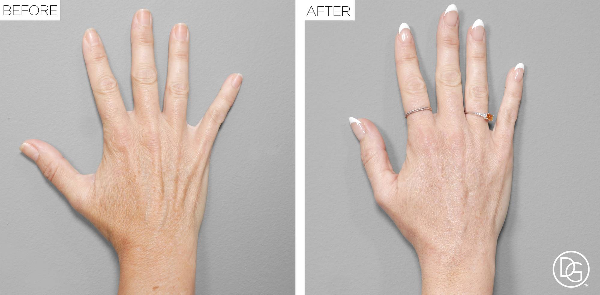 Before & After Image