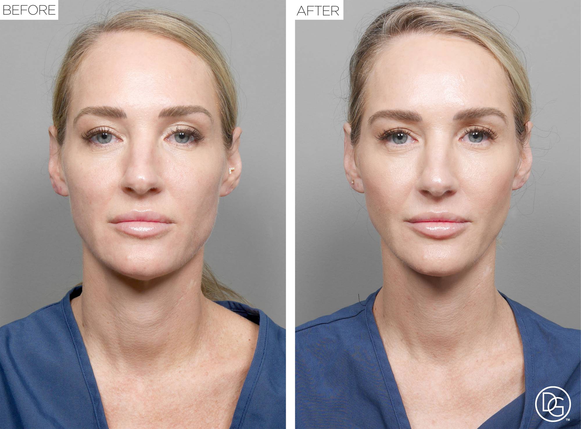 Before & After Image