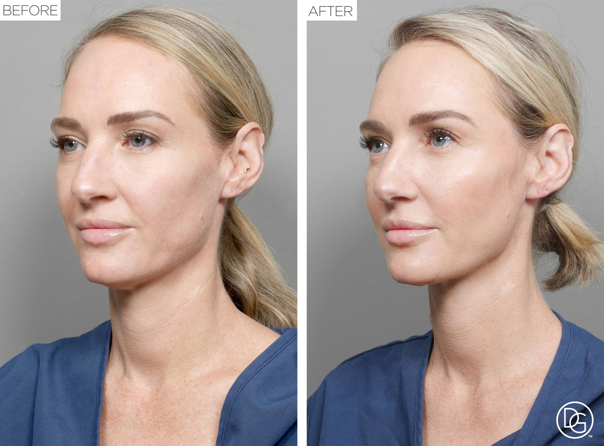 Before & After Image