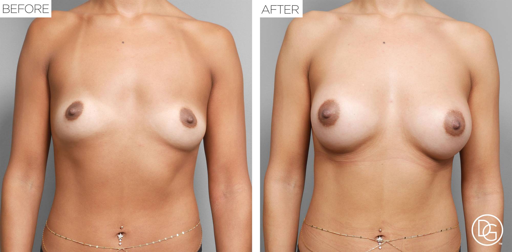 Before & After Image