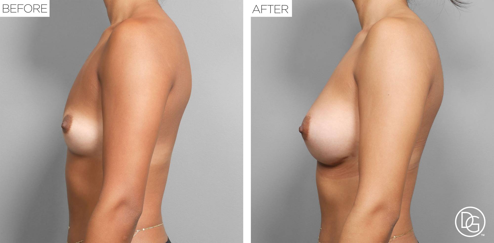 Before & After Image