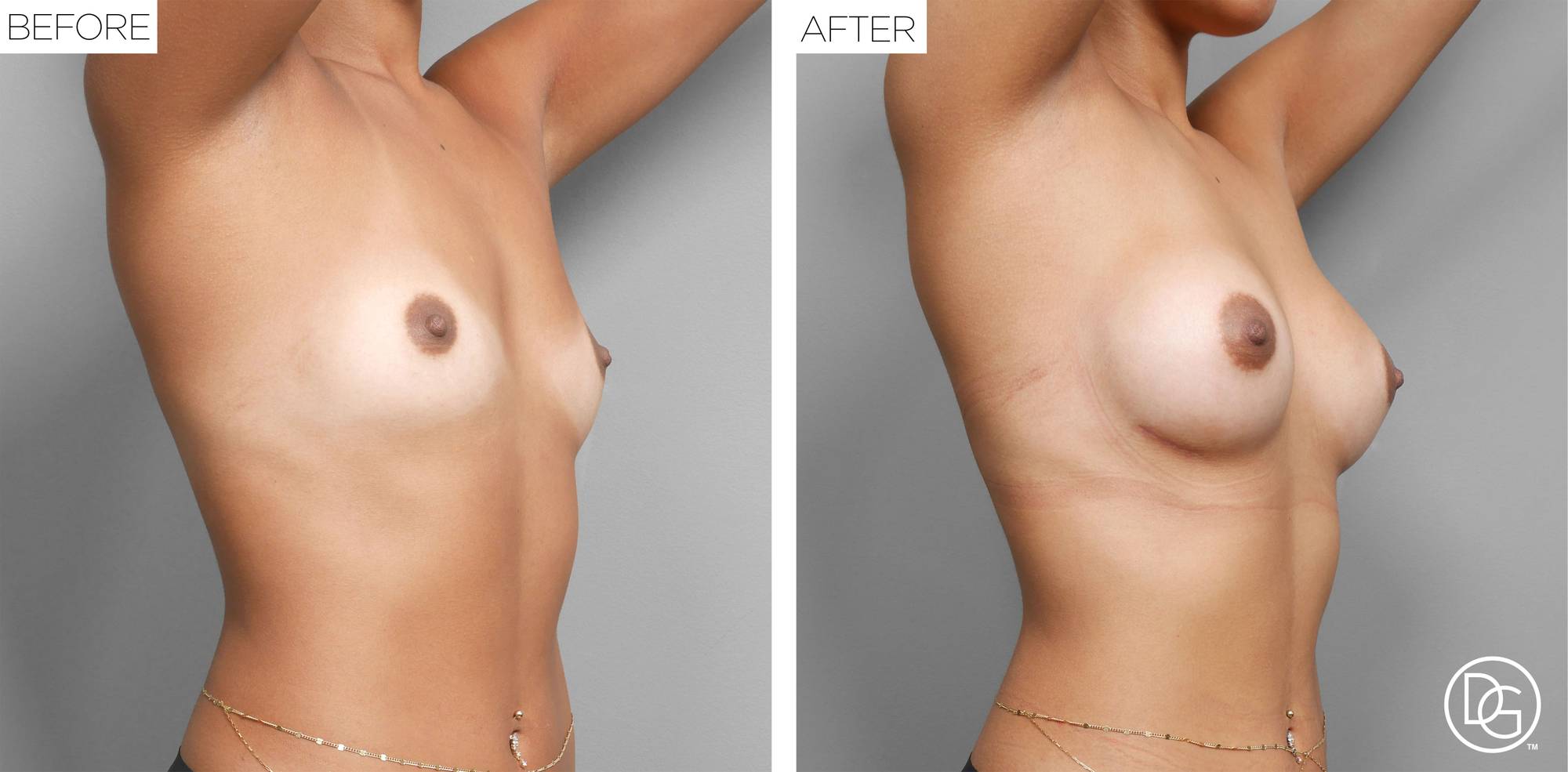 Before & After Image