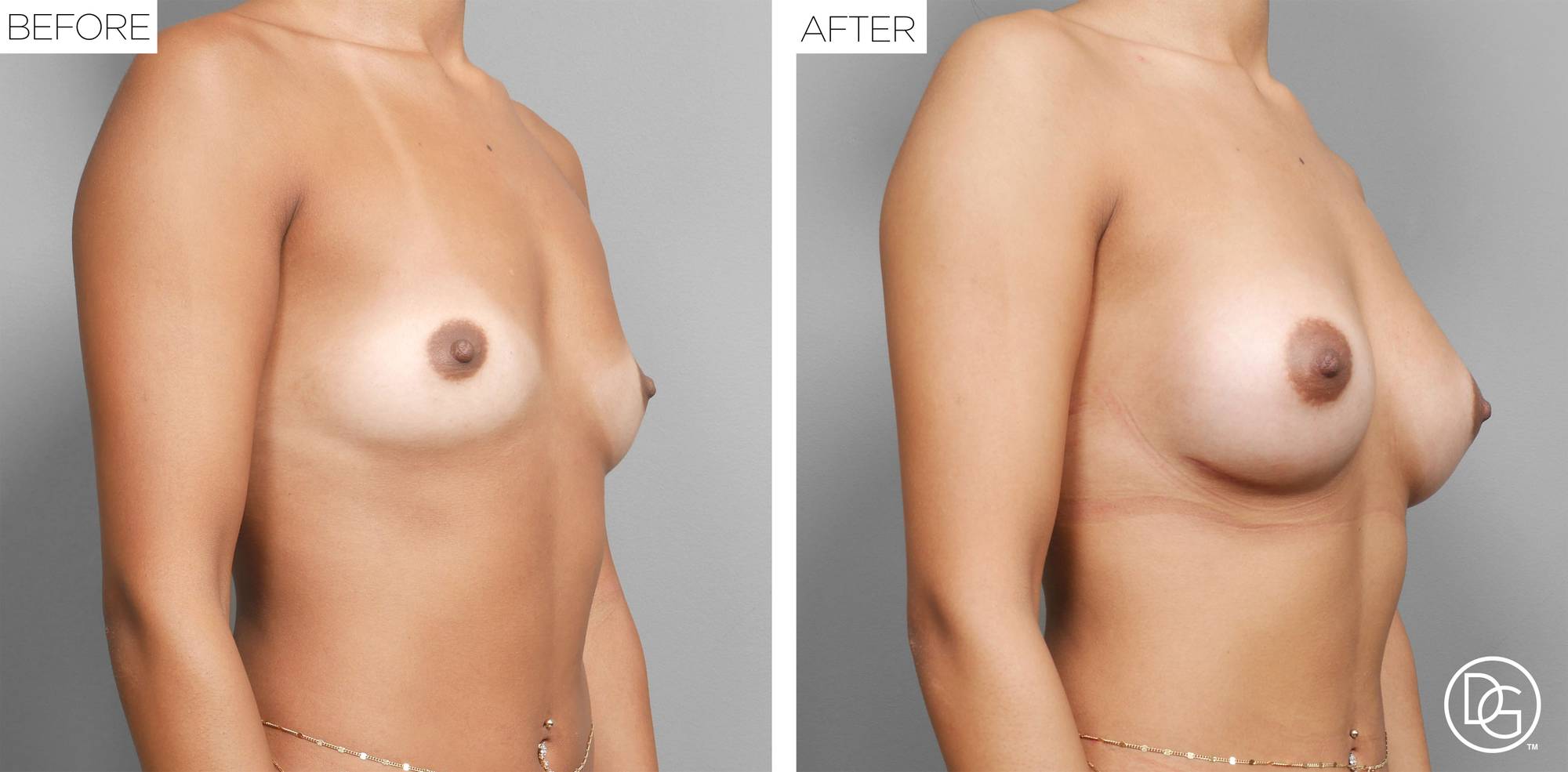 Before & After Image