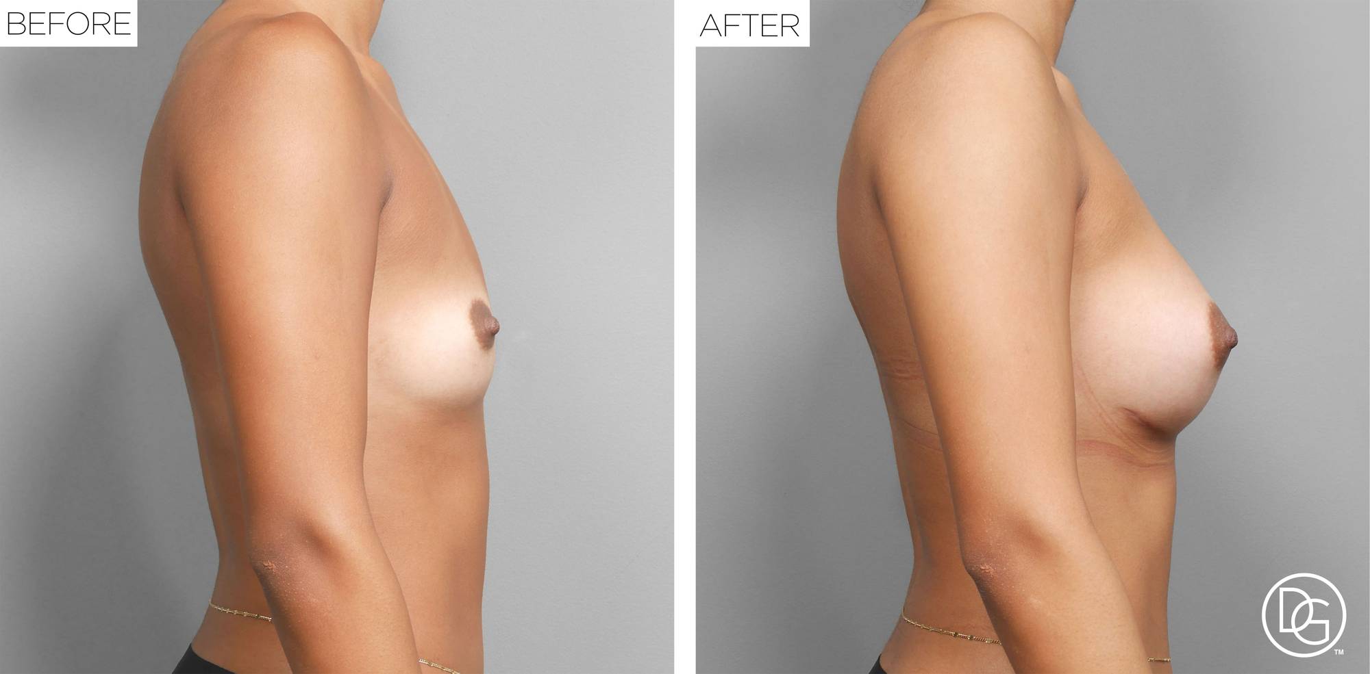 Before & After Image