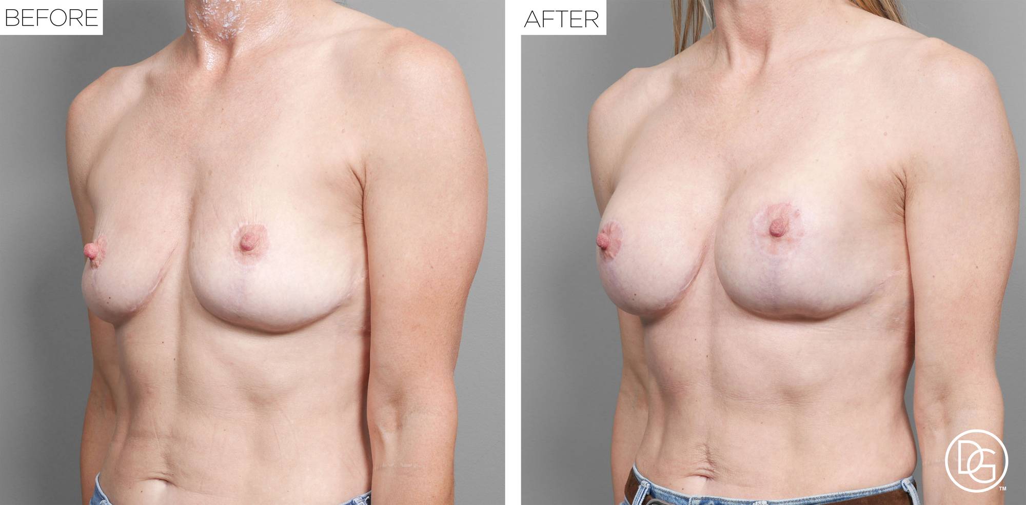 Before & After Image