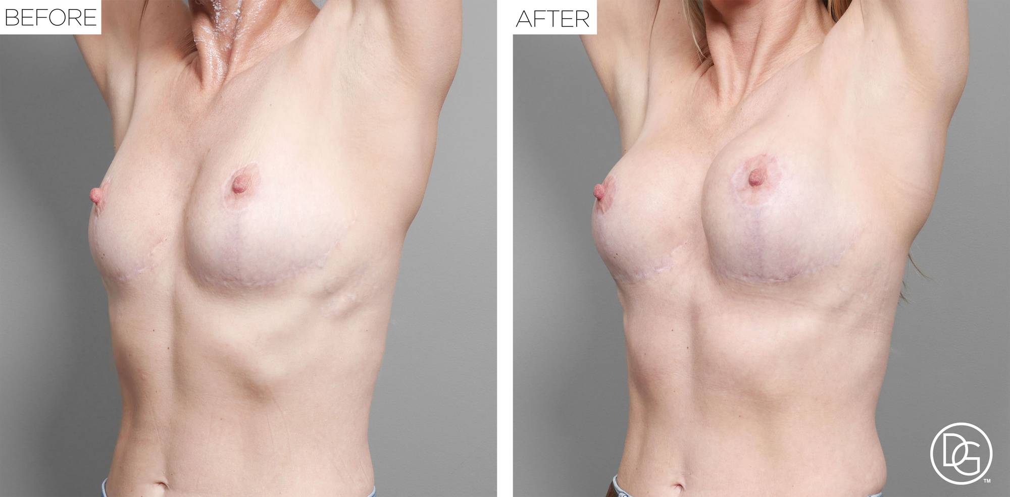 Before & After Image