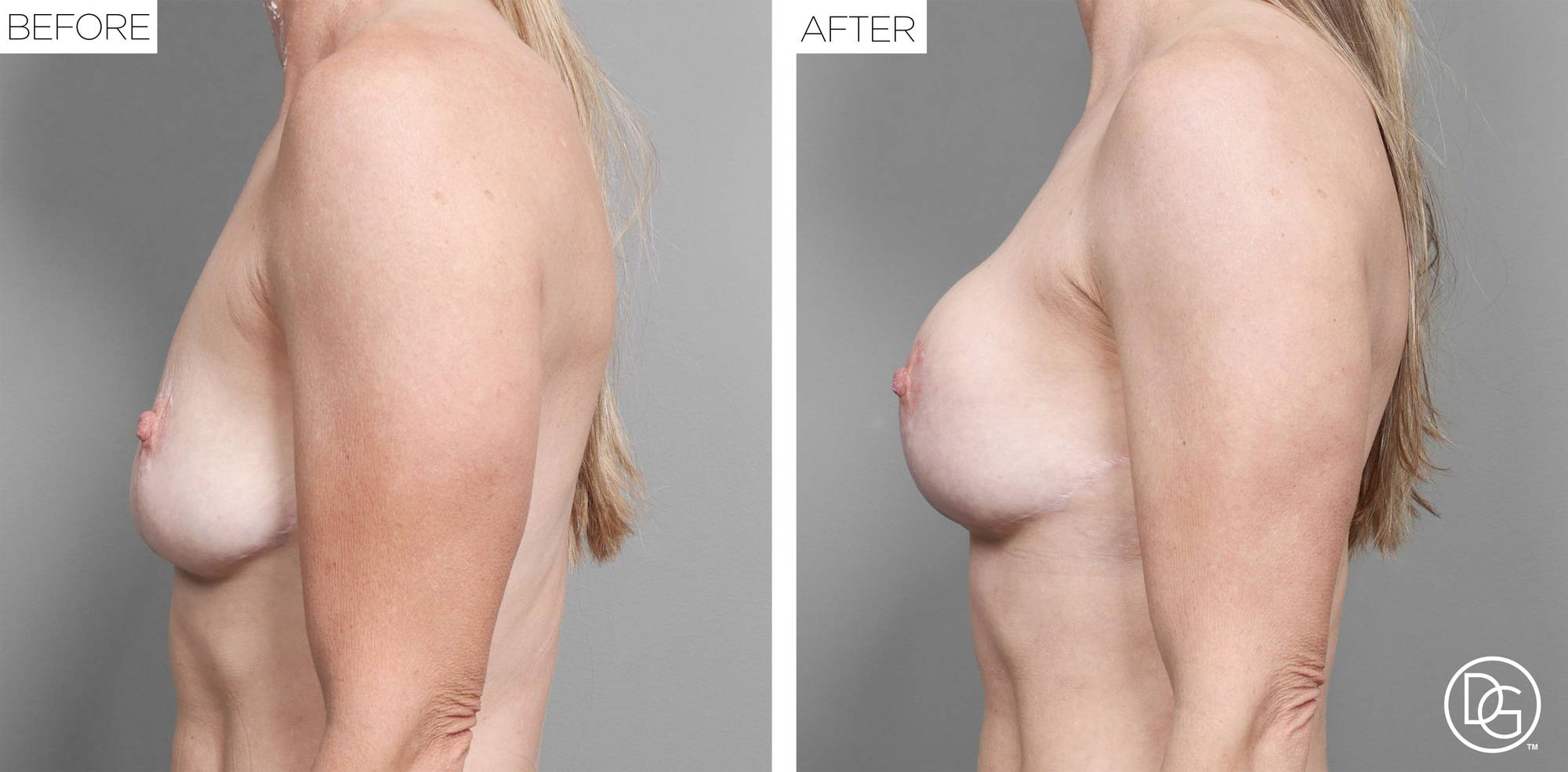 Before & After Image