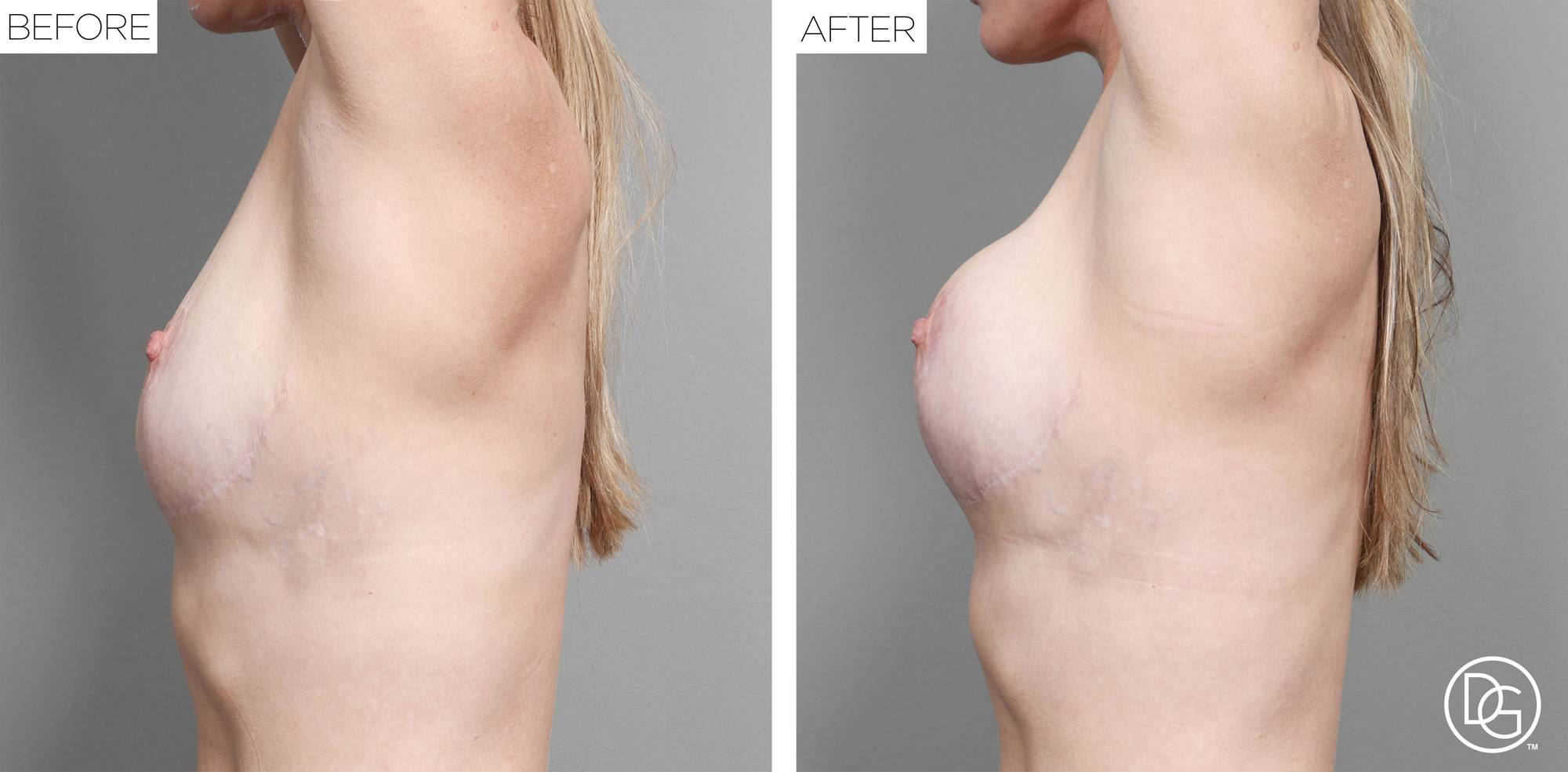 Before & After Image