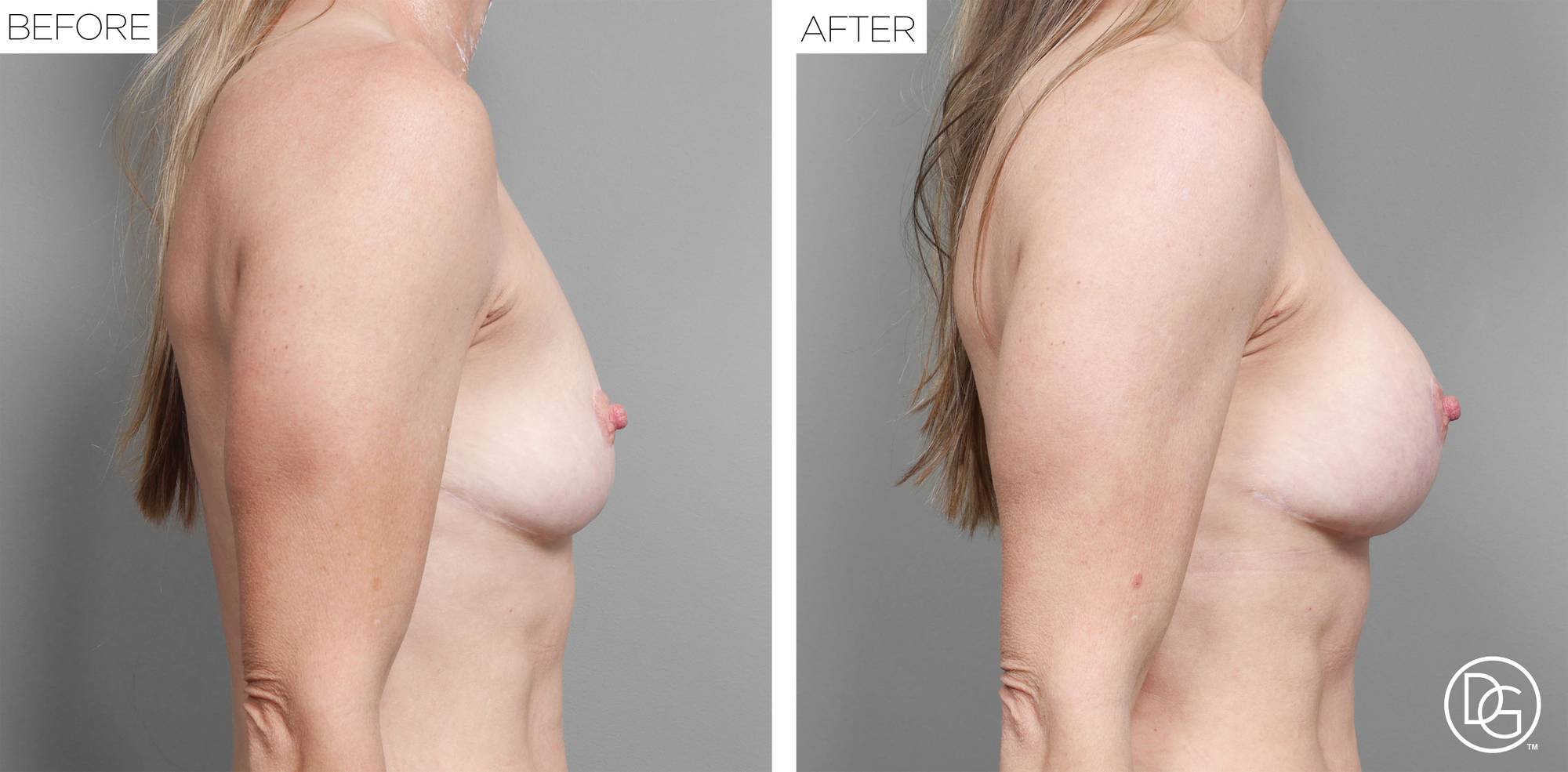 Before & After Image