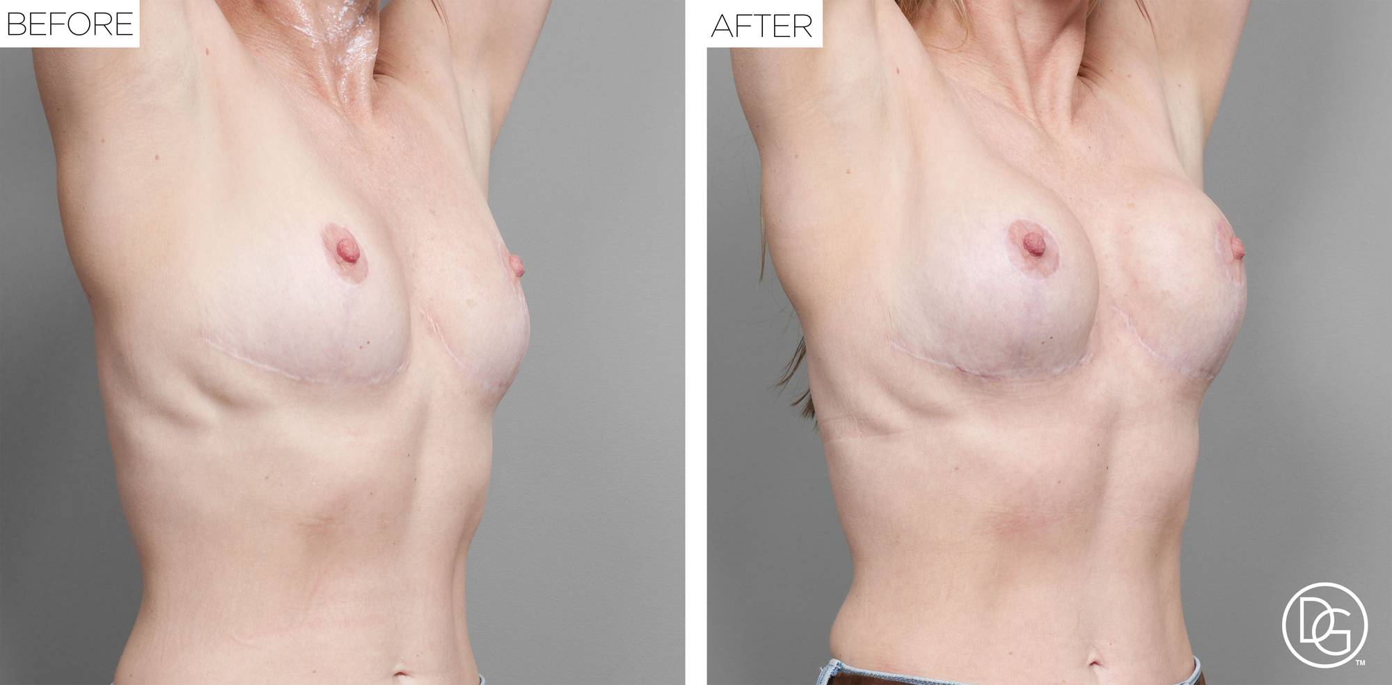 Before & After Image