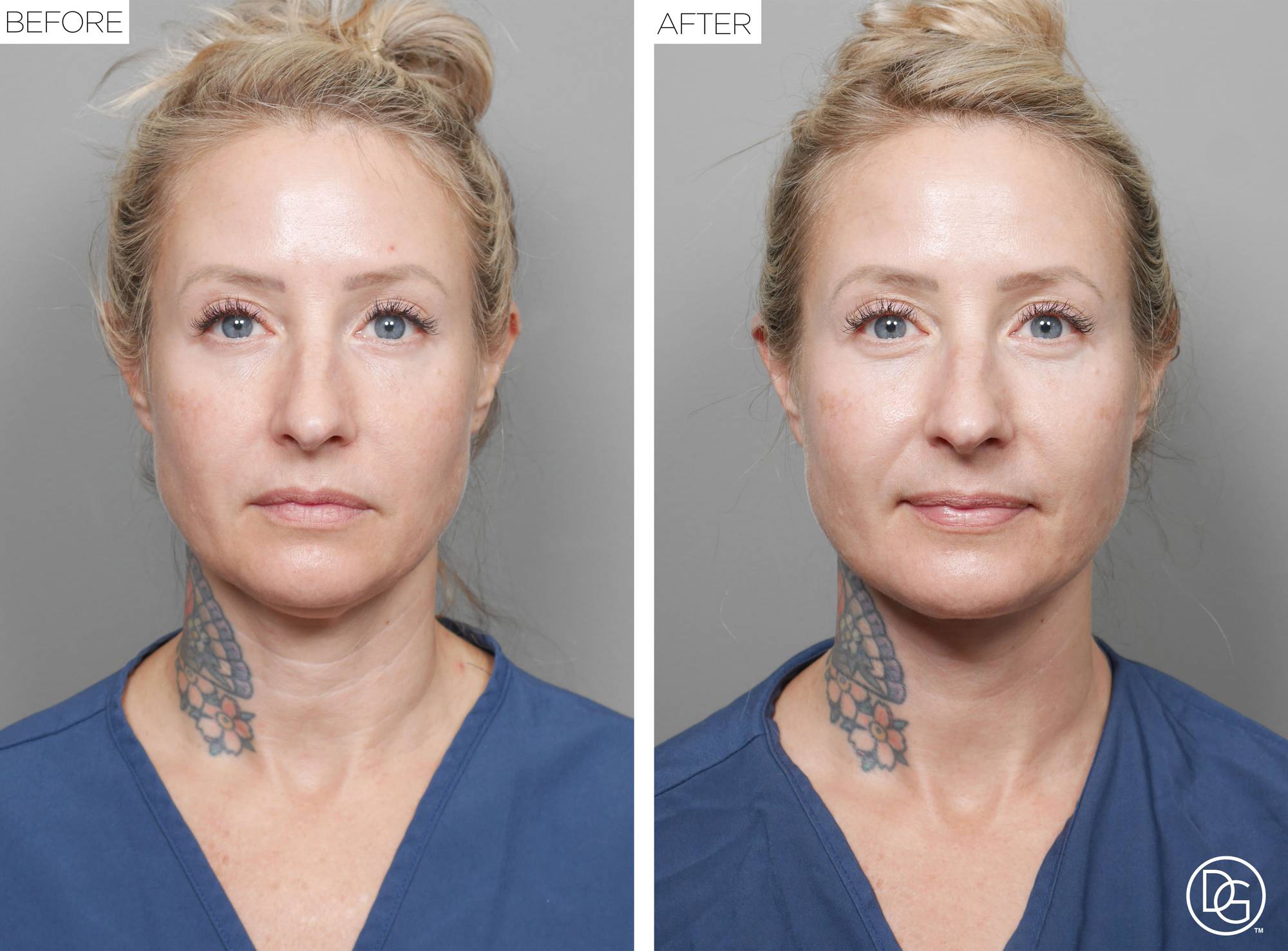 Before & After Image