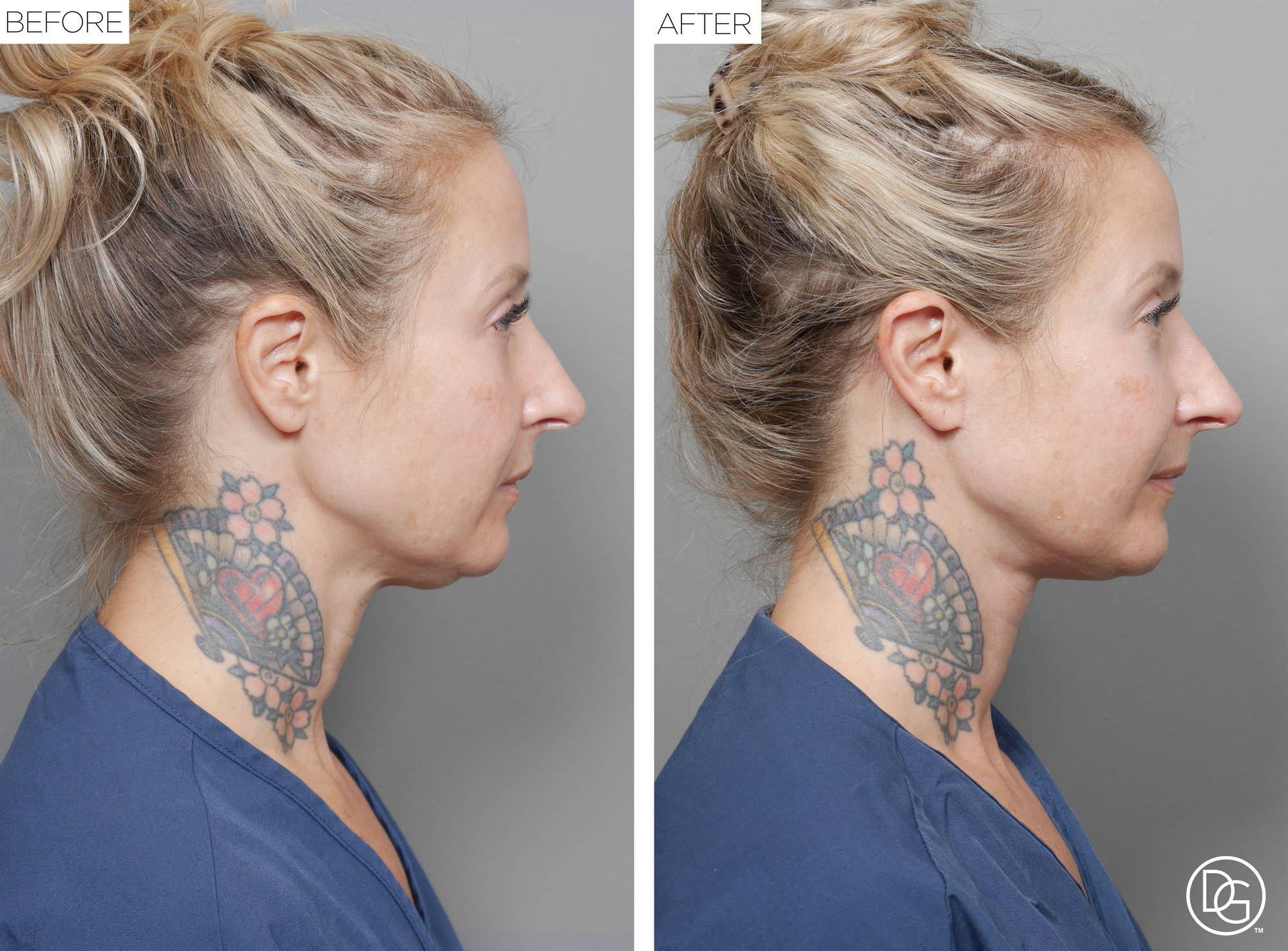 Before & After Image