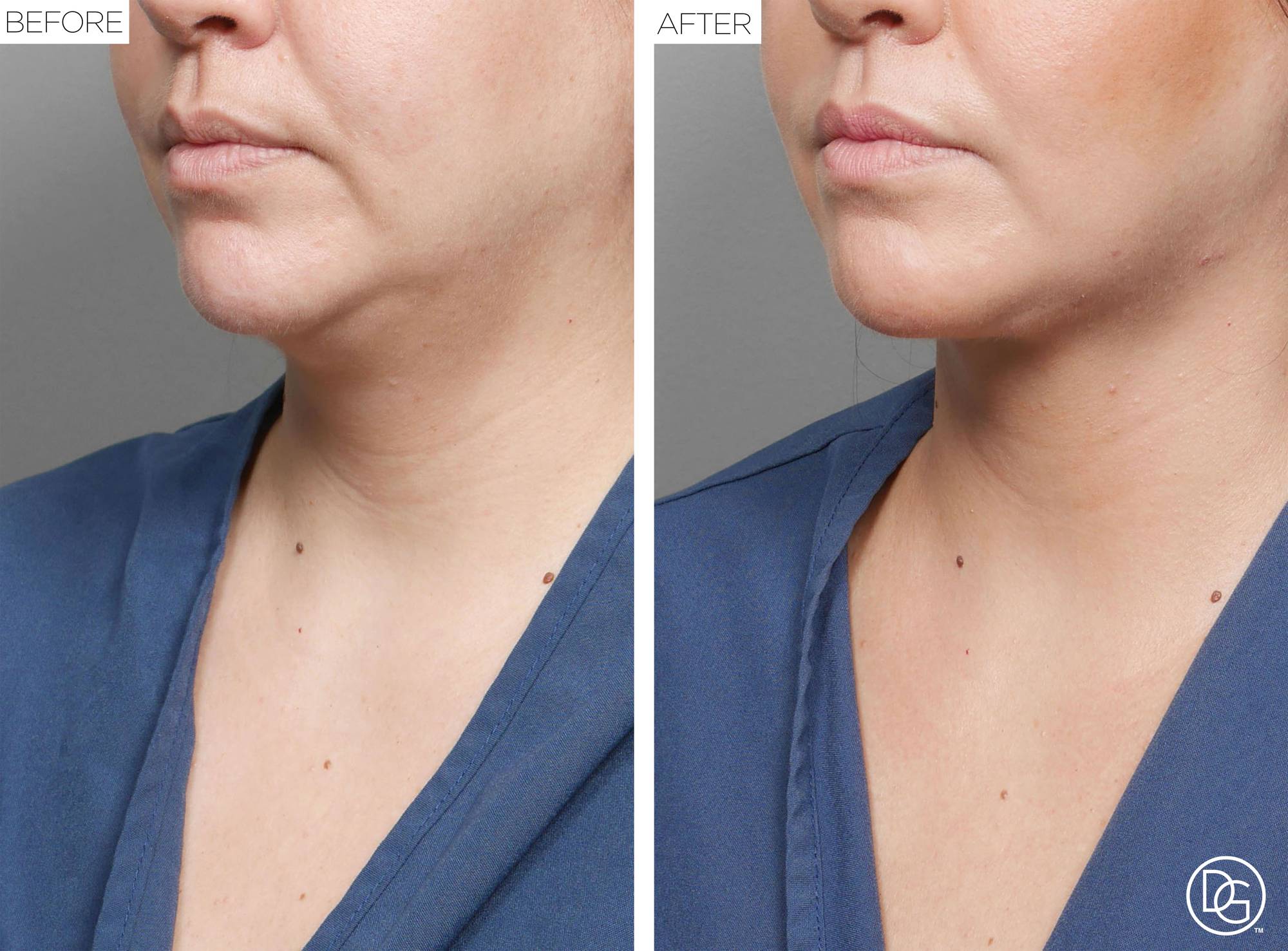 Before & After Image