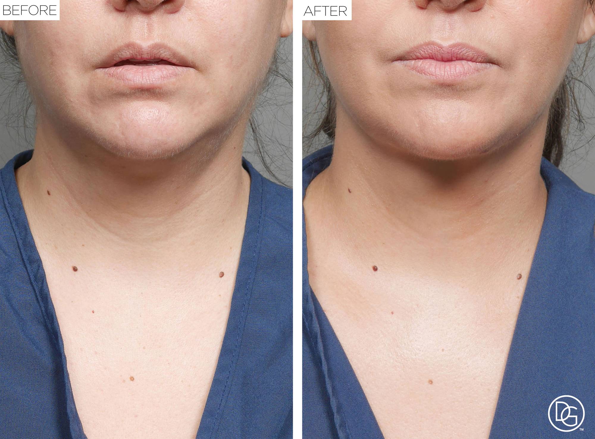 Before & After Image