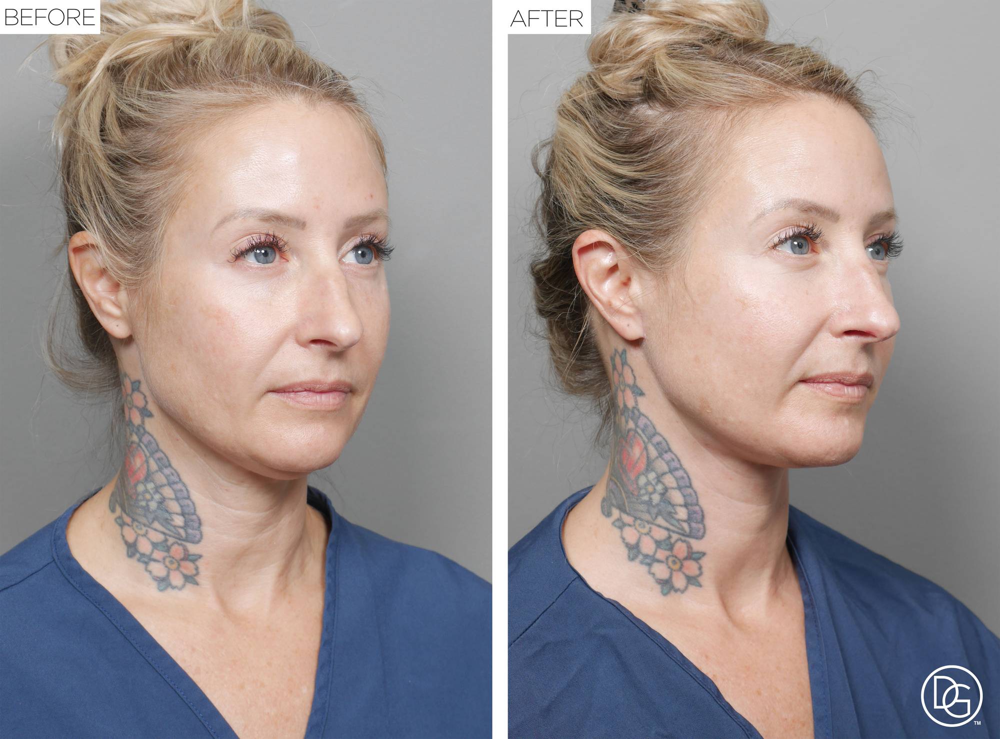 Before & After Image